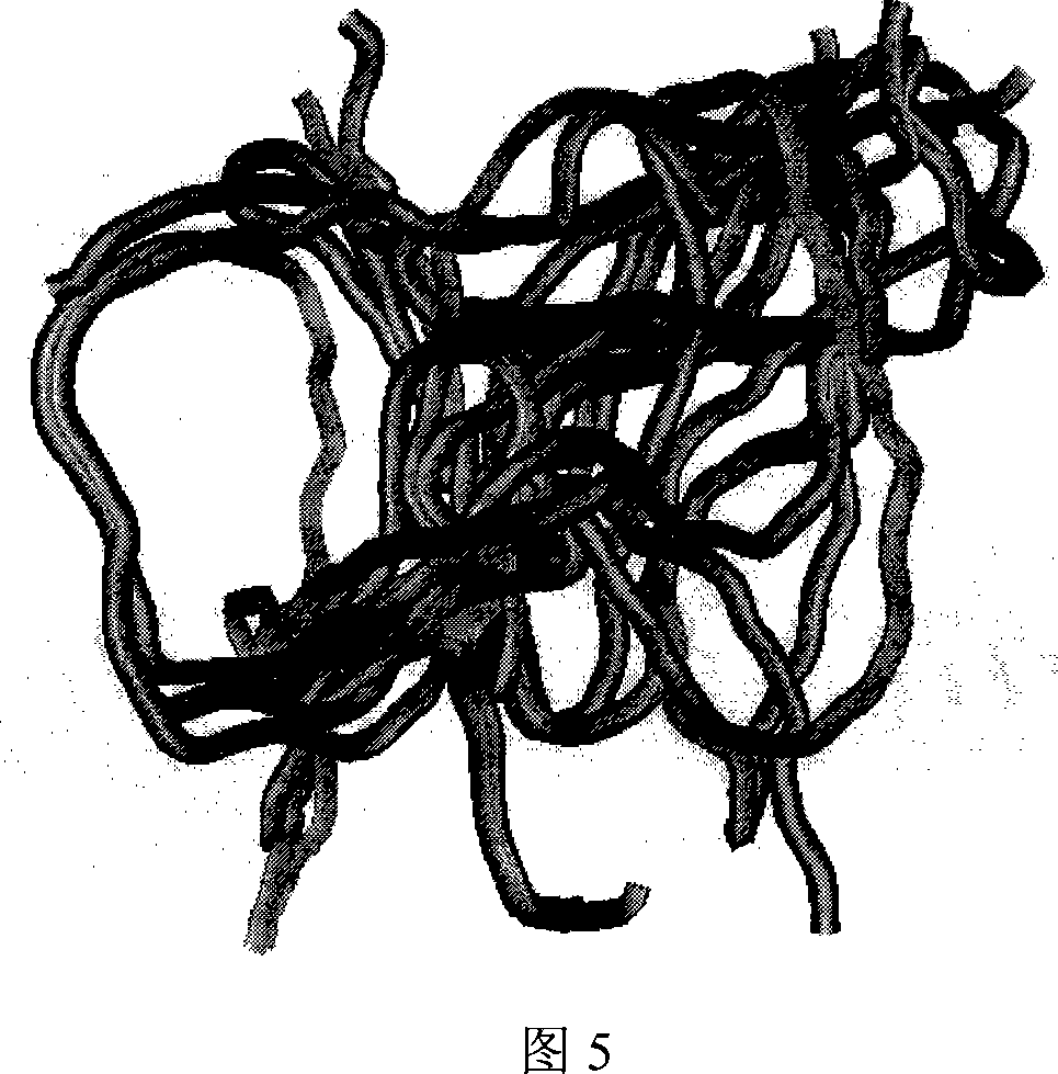 Recovery processing method for diffusion tensor magnetic resonance image