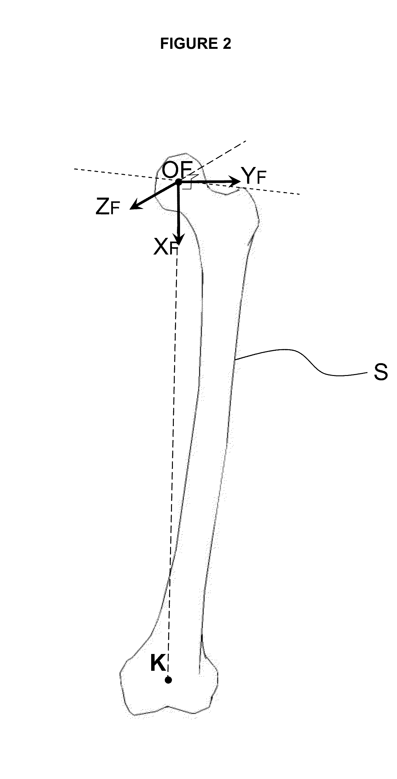 Method of determination of access areas from 3D patient images