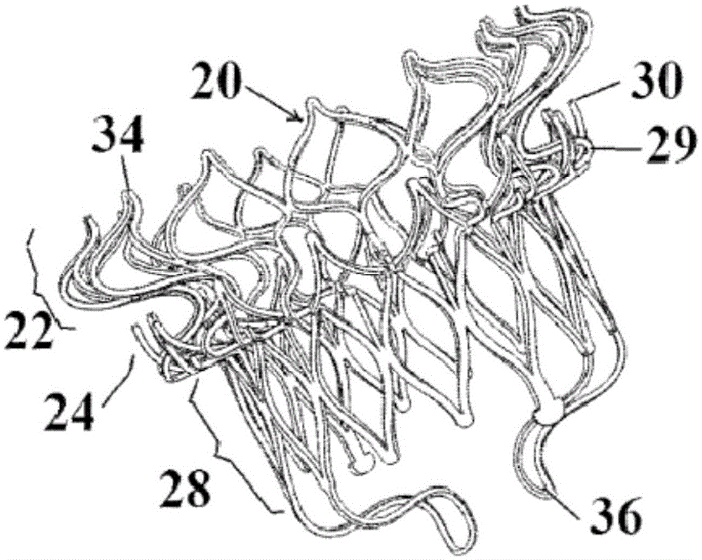 Device and method for mitral valve regurgitation method