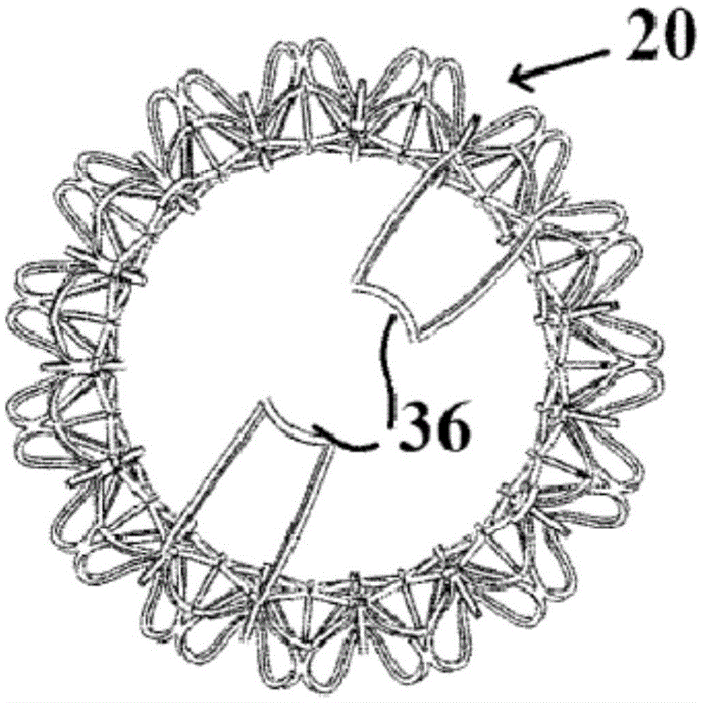 Device and method for mitral valve regurgitation method