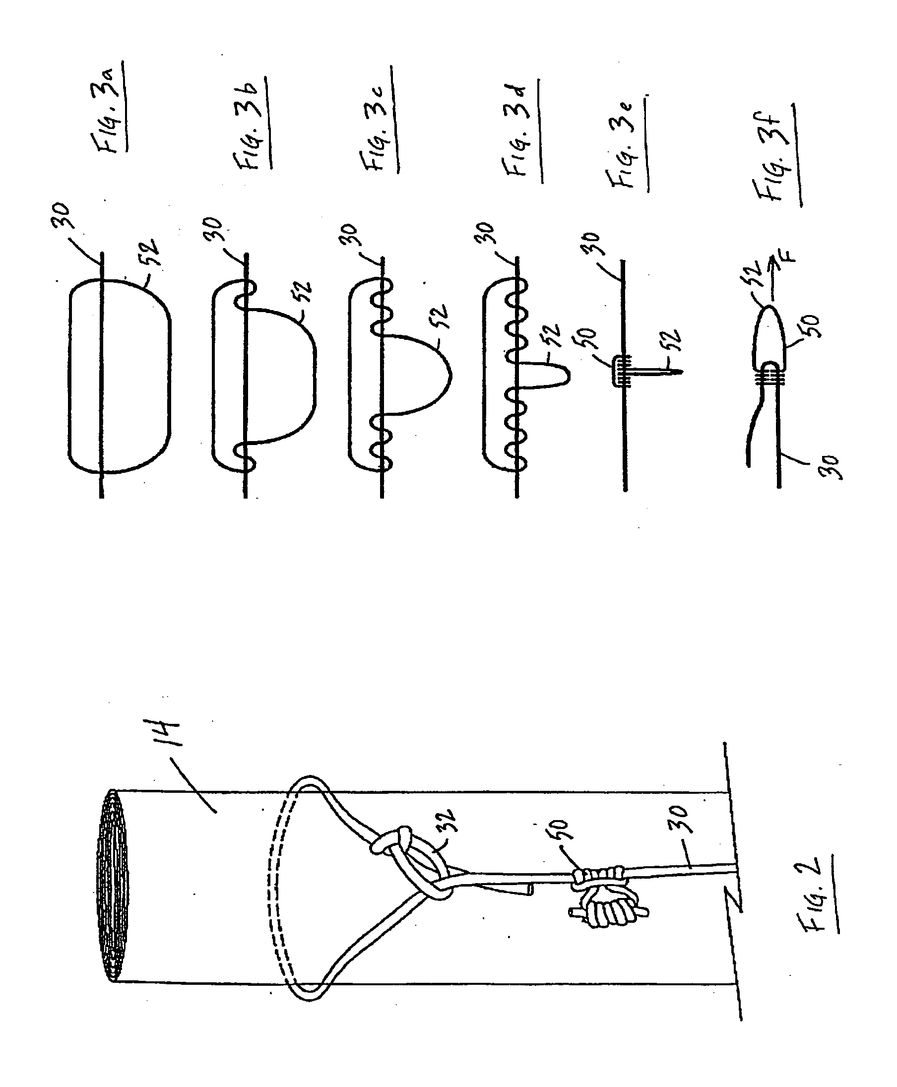 Adjustable safety line