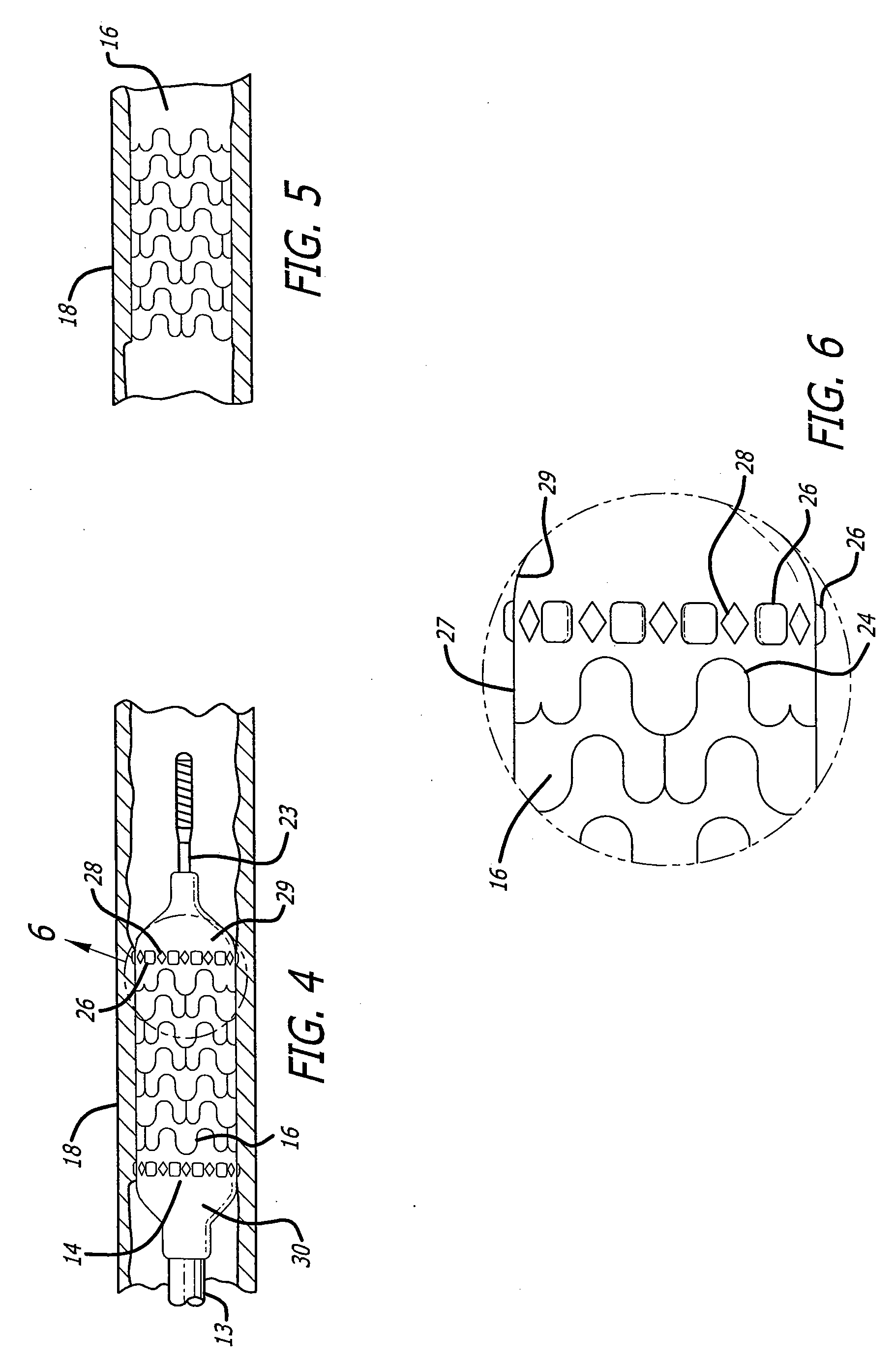 Easy marker placement balloon mold