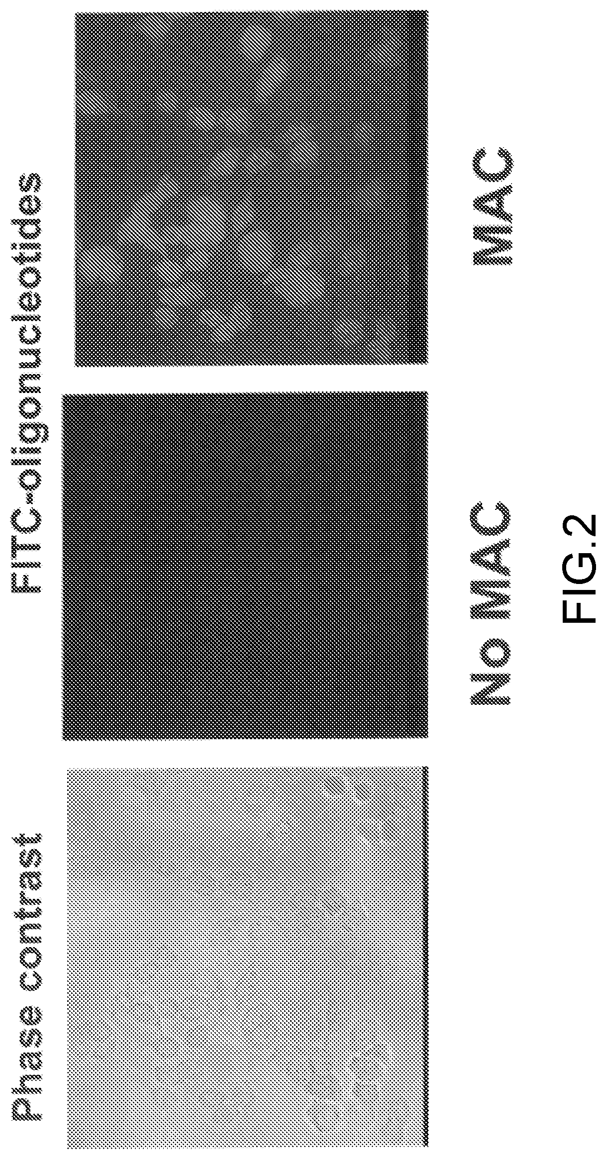 Membrane attack complexes and uses thereof