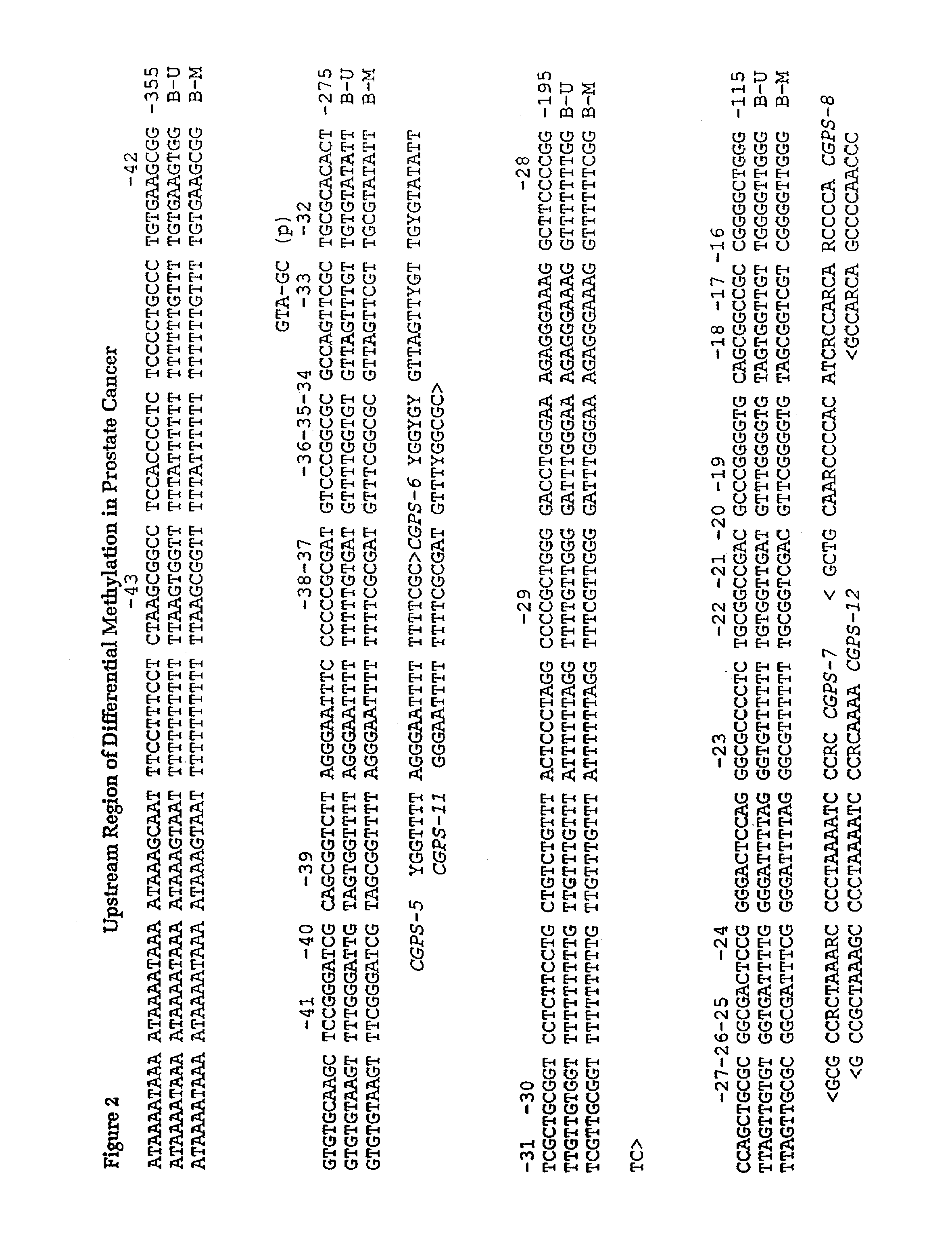 Assay for methylation in the GST-Pi gene