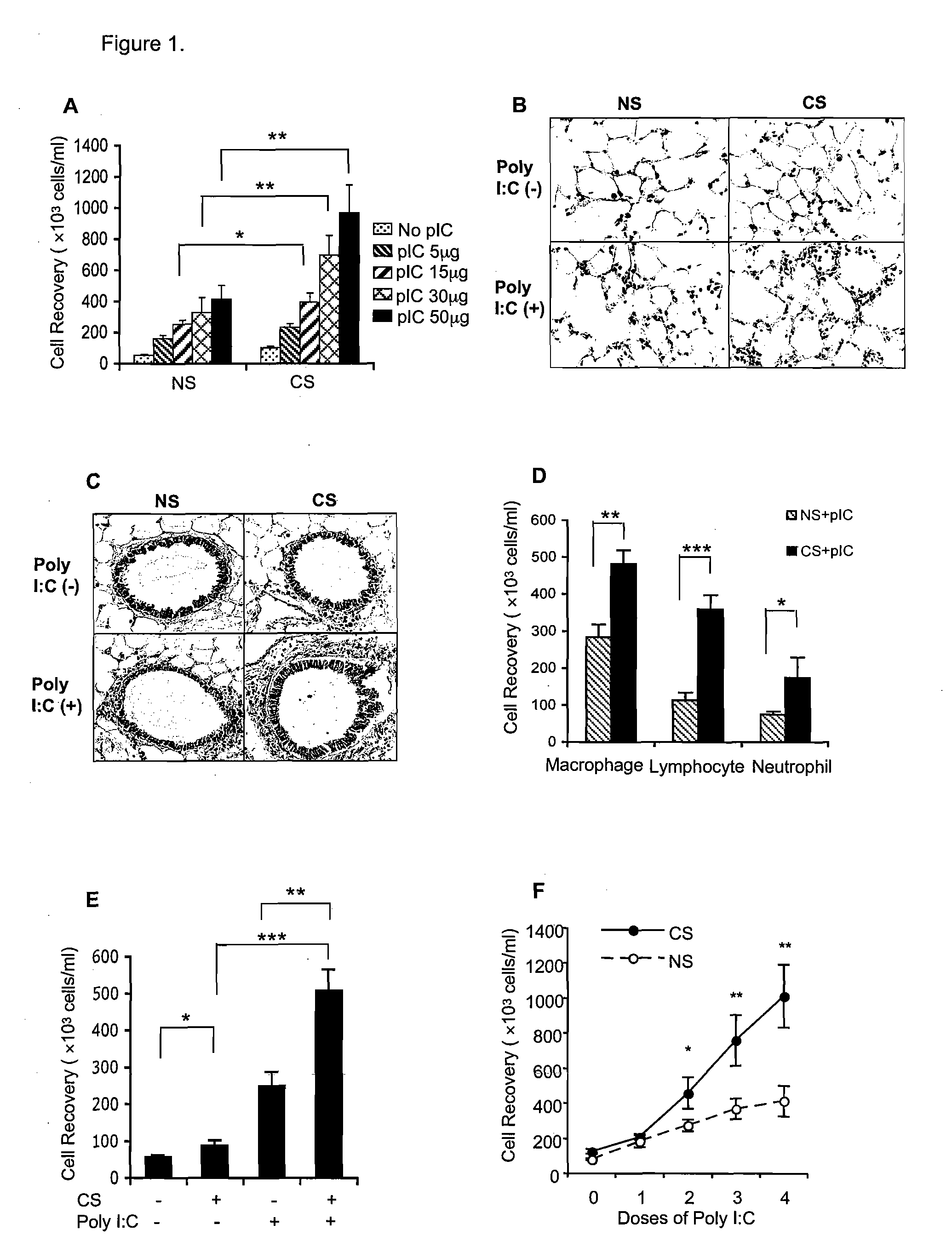 IL-18 and Protein Kinase R Inhibition for the Treatment of COPD