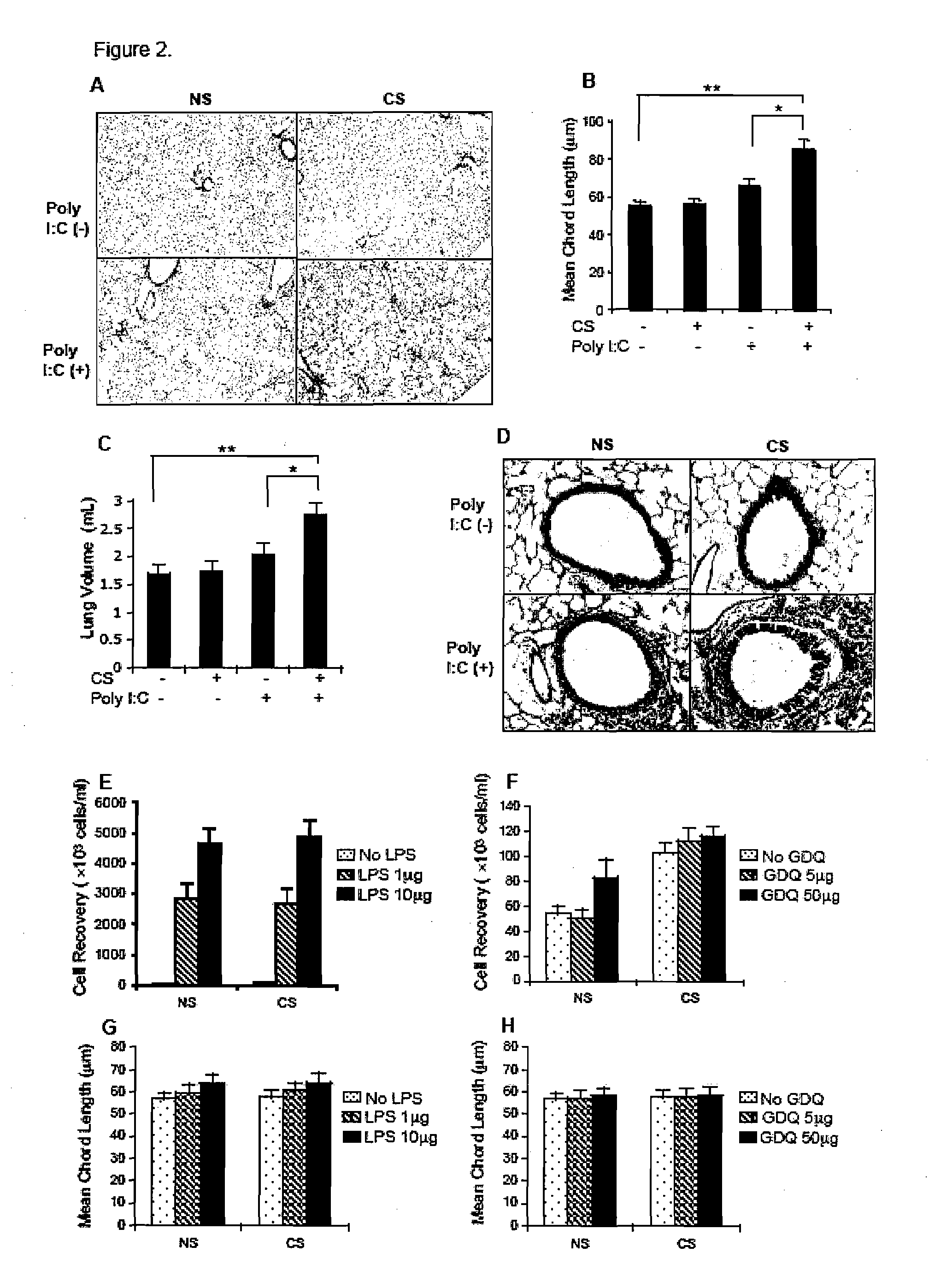 IL-18 and Protein Kinase R Inhibition for the Treatment of COPD