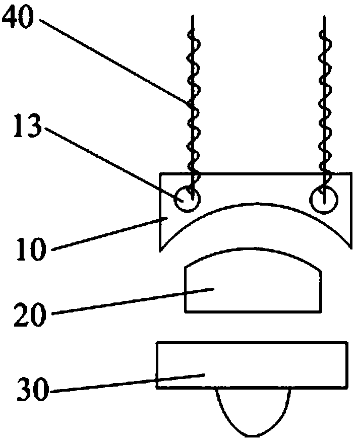 Single ankle joint surface replacement system