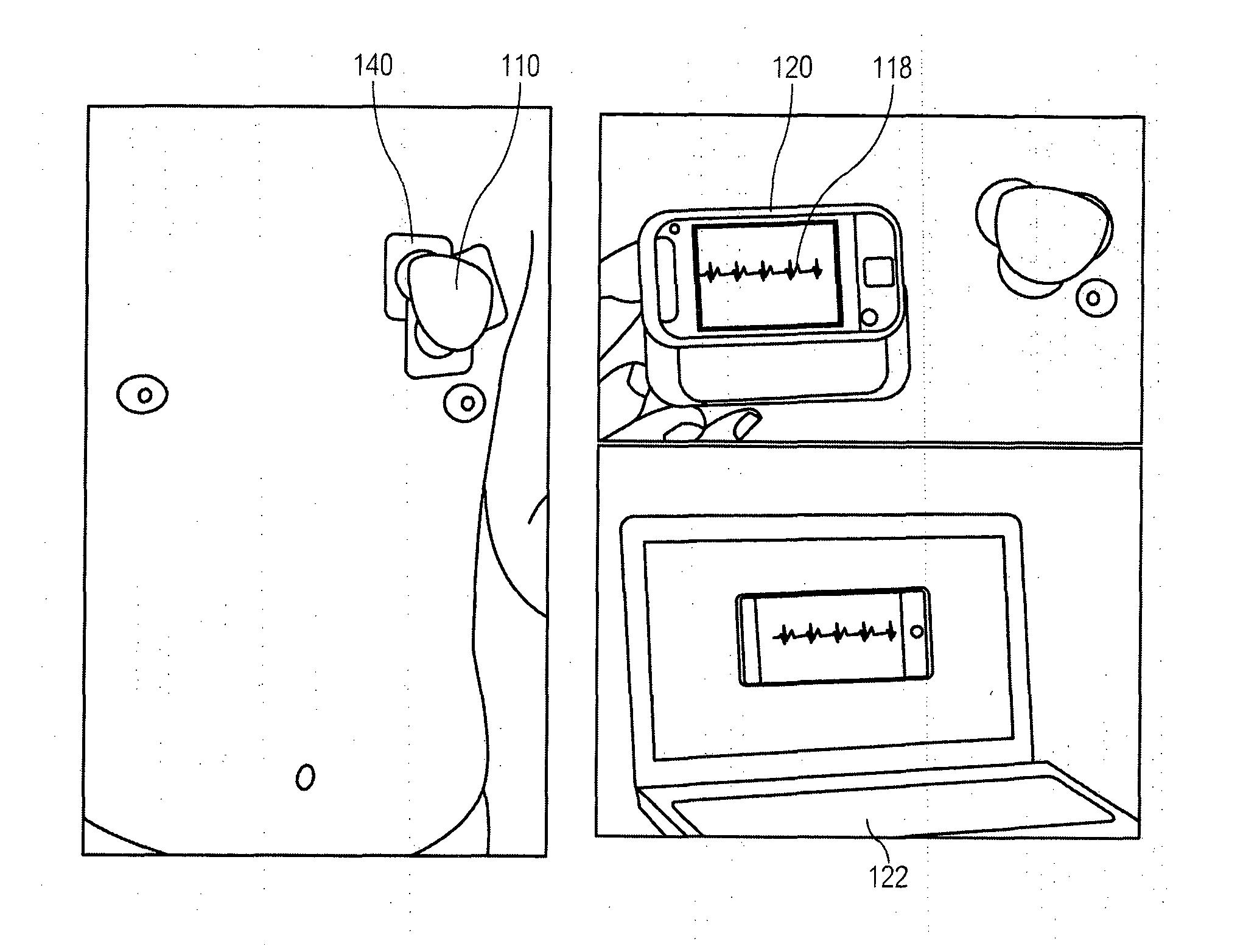 Electrocardiographic monitoring system