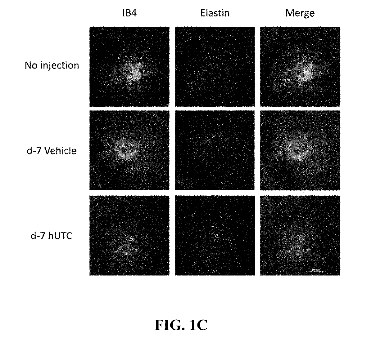 Method of inhibiting angiogenesis