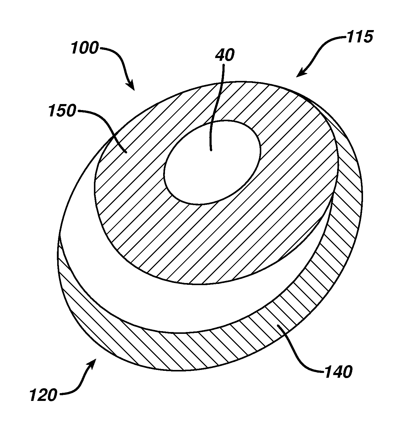 Directional tissue expander