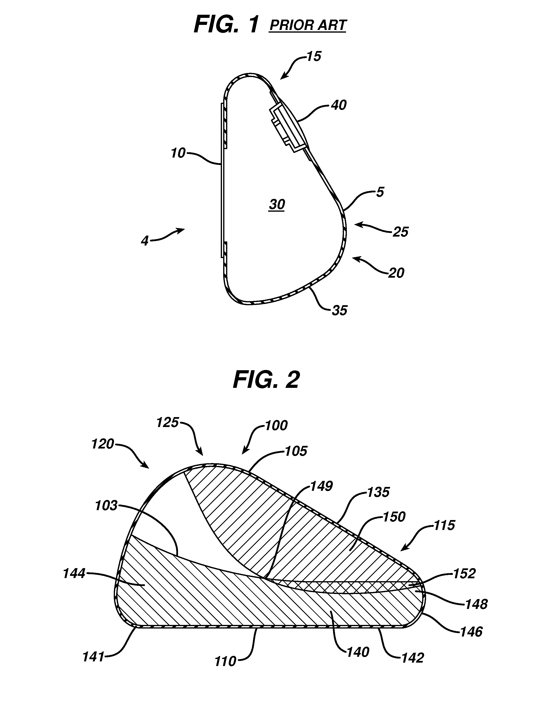 Directional tissue expander