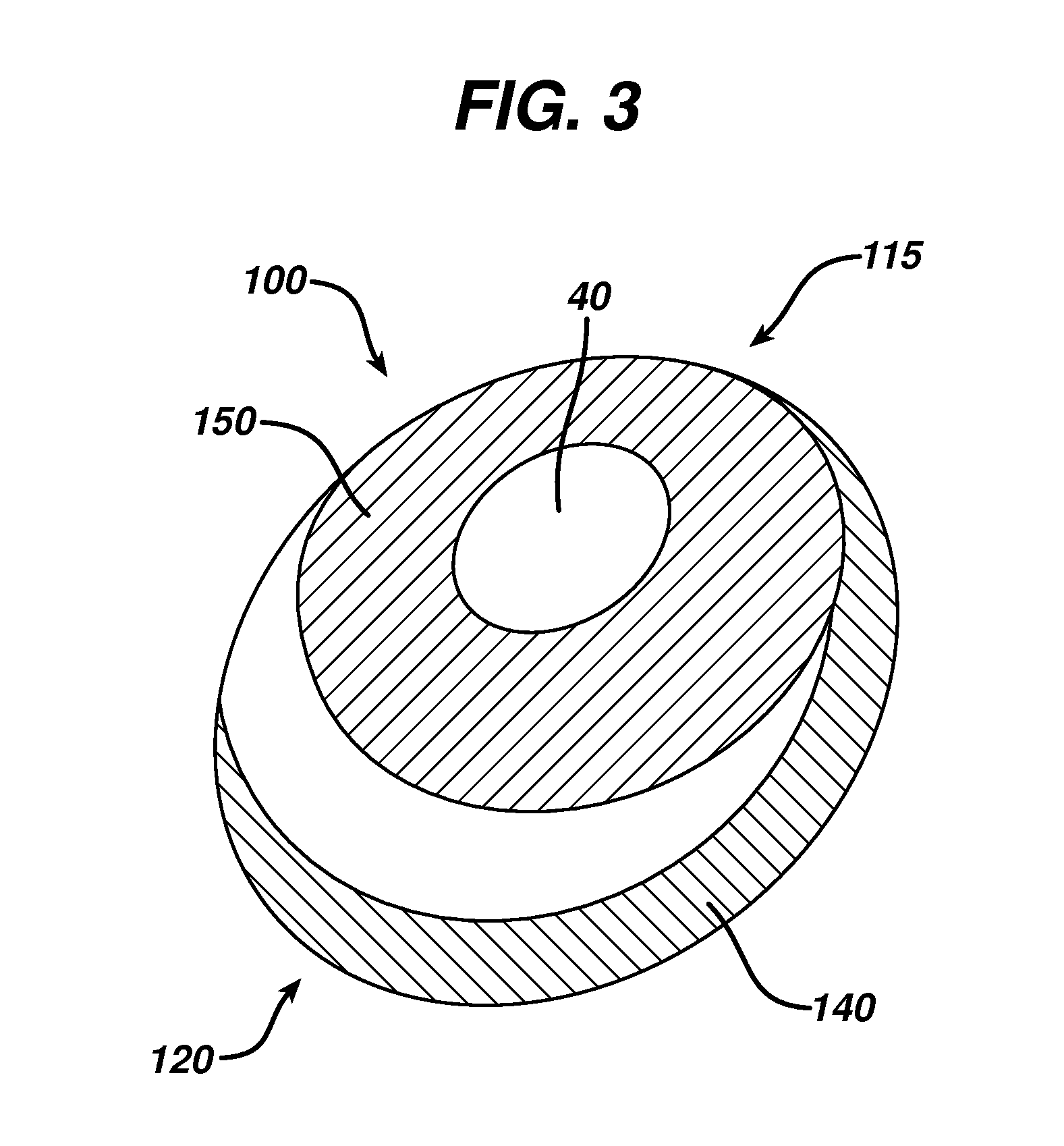 Directional tissue expander