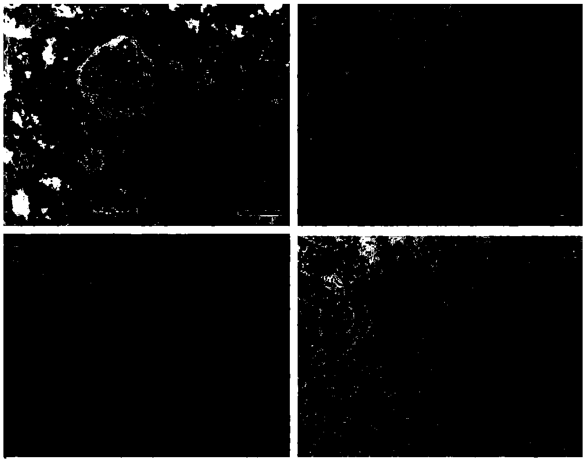 Application of paeoniflorin-6-O'-benzenesulfonate