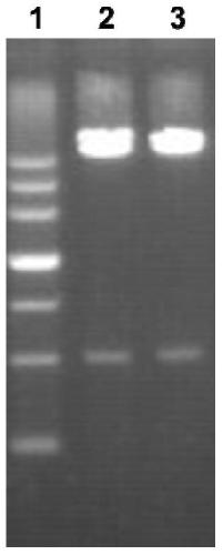 A kind of recombinant protein VO and its preparation method and application