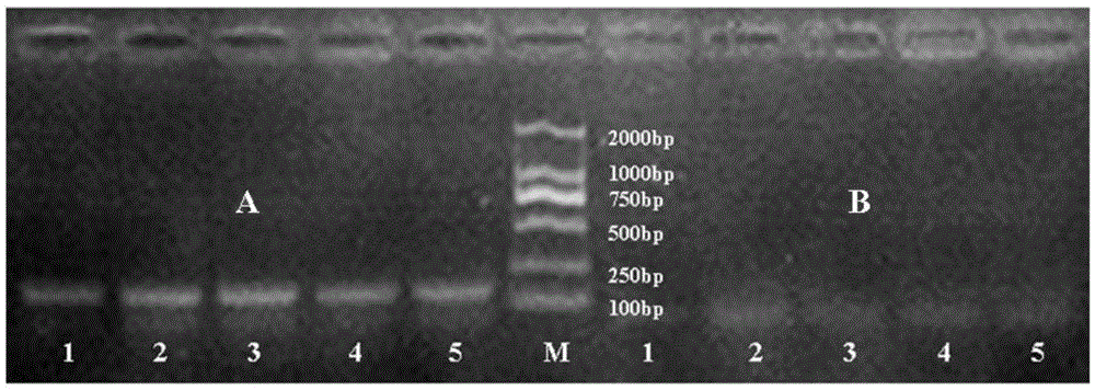 A kind of primer and method for distinguishing larvae of A. lepidus and A. sylvaticus using est microsatellite markers