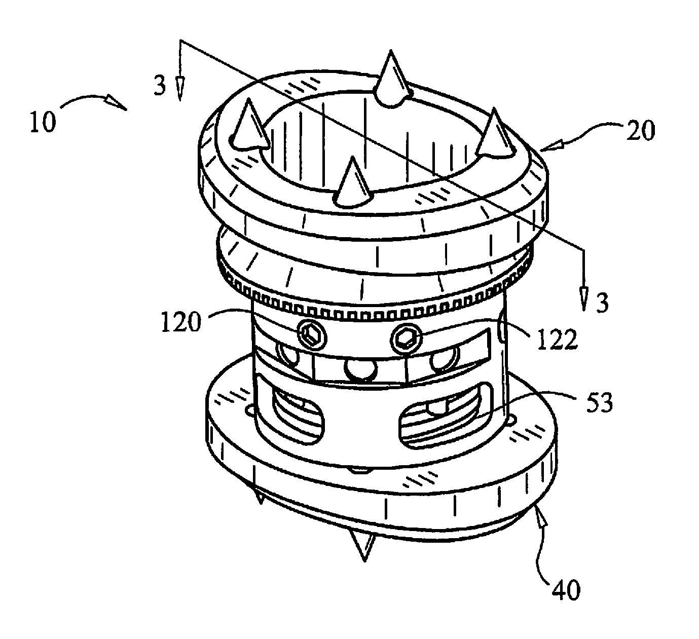 Expandable Vertebral Prosthesis