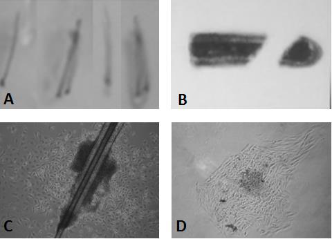 Method for evaluating hair regeneration effect of lyophilized powder by measuring cytokine content