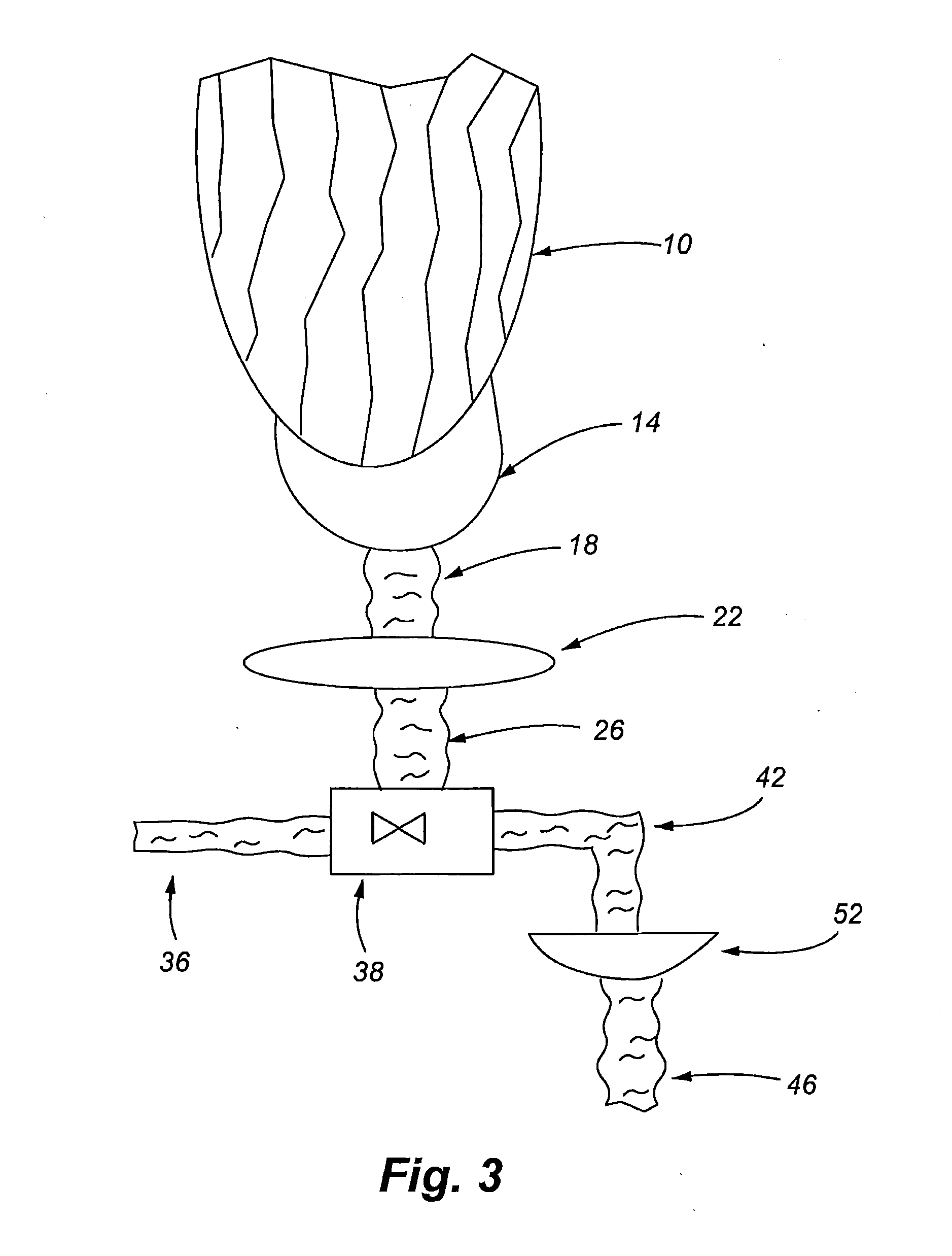 Method and system for processing glacial water