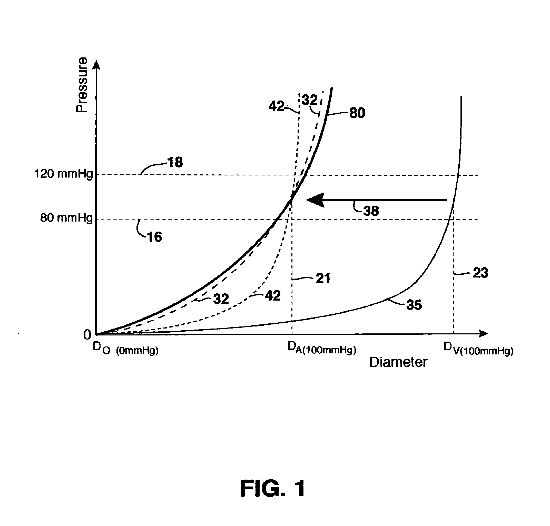 Compliant blood vessel graft