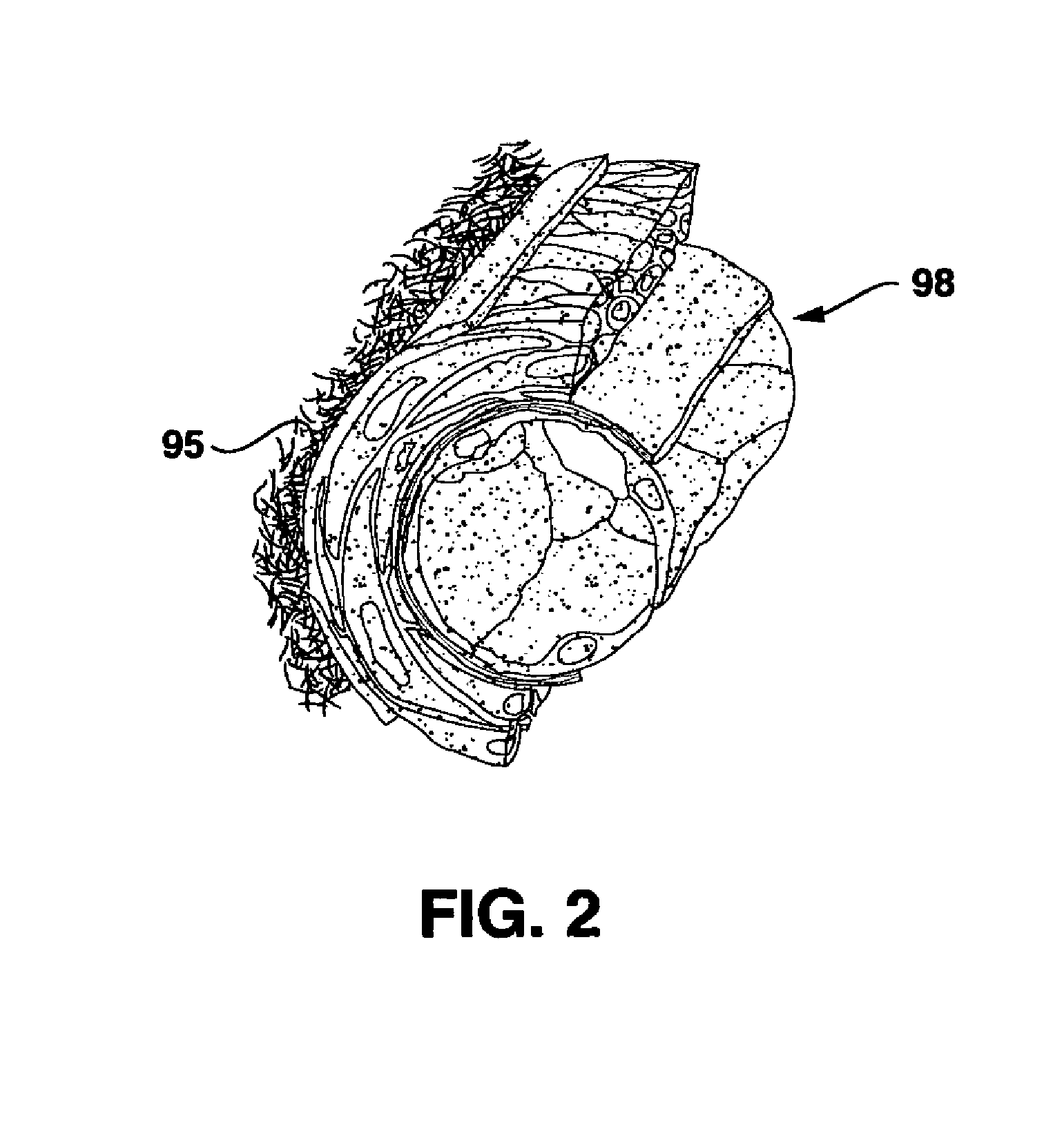 Compliant blood vessel graft