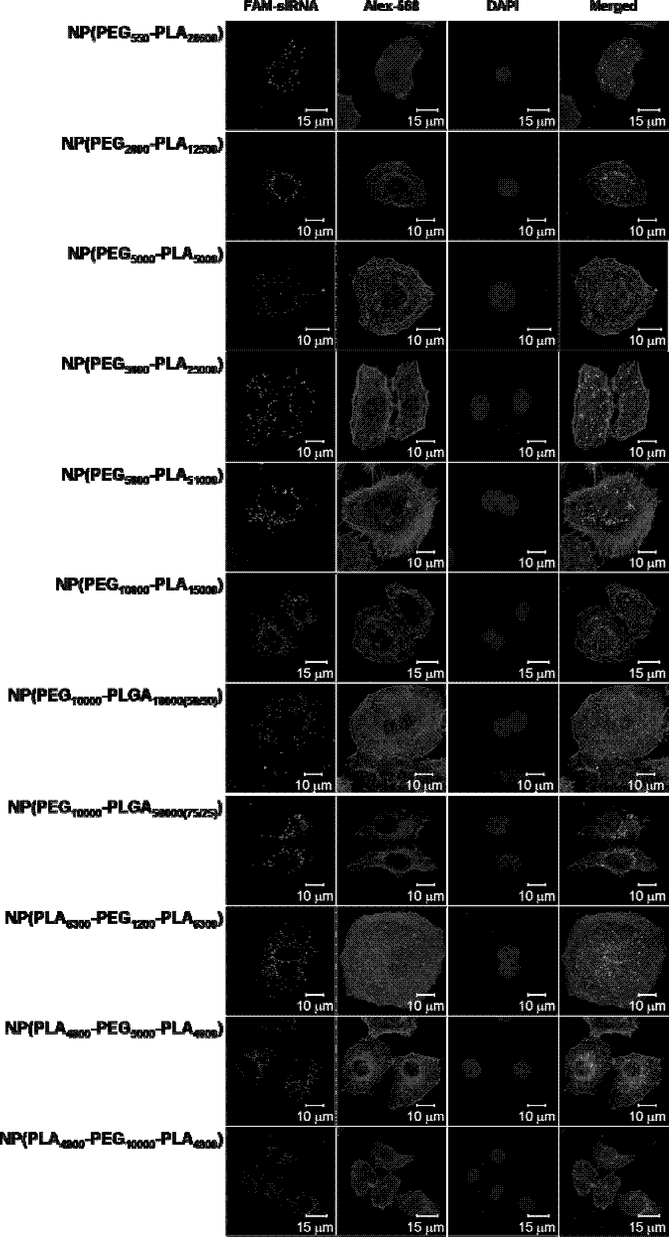 Drug delivery system of small interfering RNA drug and preparation