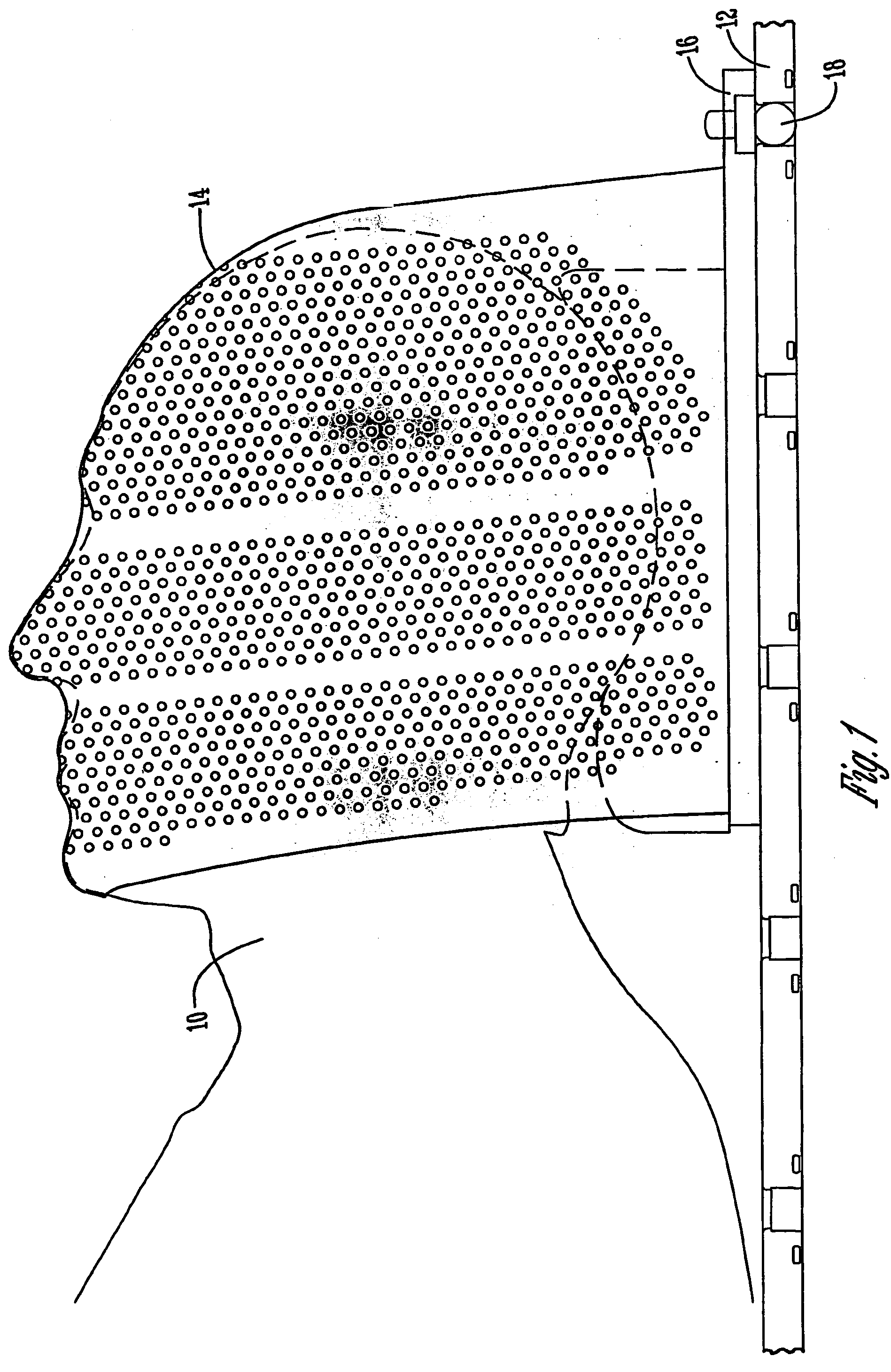 Reinforced thermoplastic patient restraints for radiation therapy