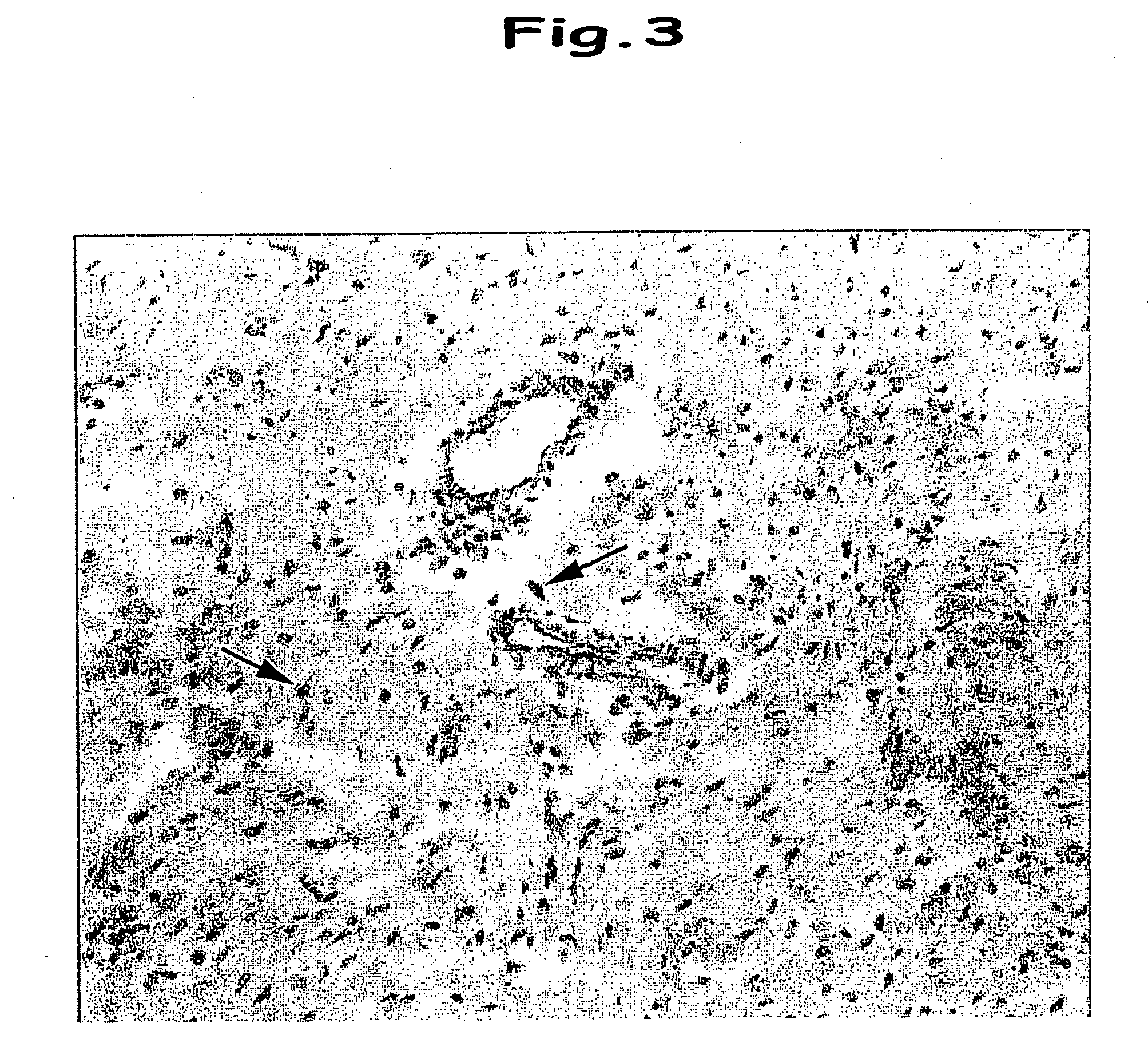 Prodrug, medicinal utilization thereof and process for producing the same