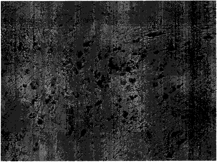 Tissue engineered breast transplant and constructing method thereof