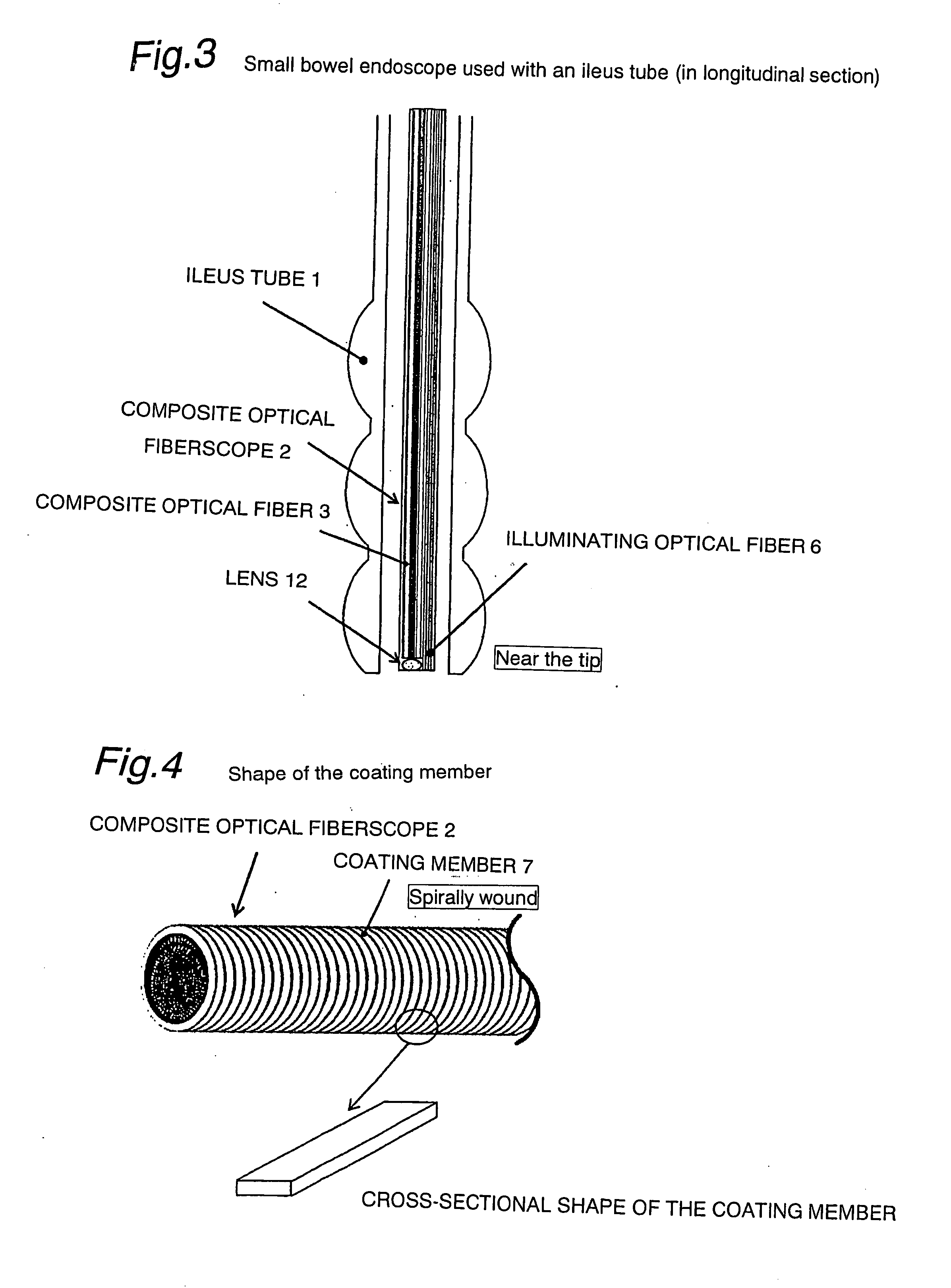 Small bowel endoscope of ileus tube type that enables laser inspection and therapy