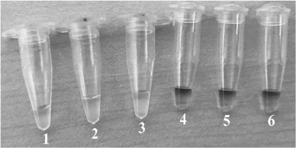 LAMP primer composition used for detecting candida parapsilosis and LAMP detection kit and application method thereof