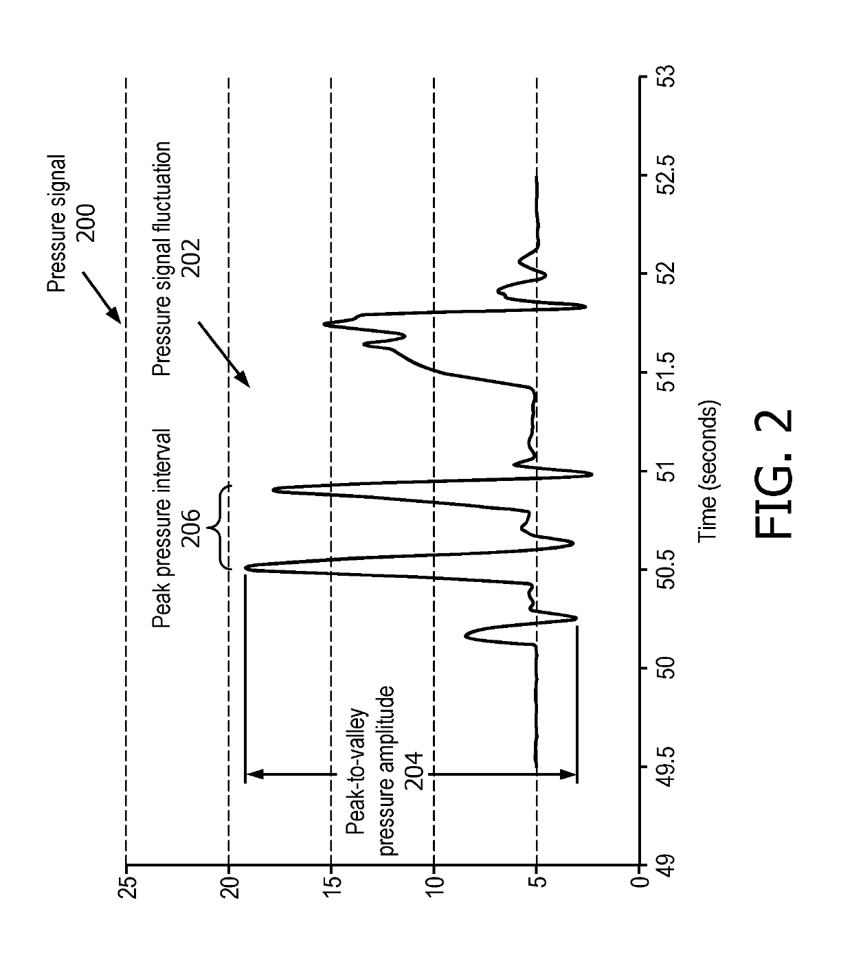 Cough detection in a respiratory support system