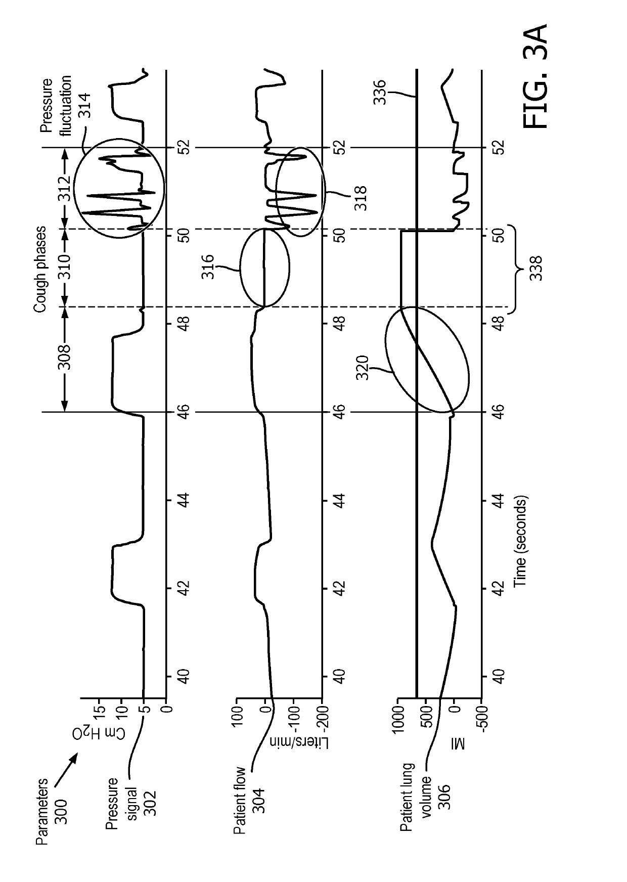 Cough detection in a respiratory support system