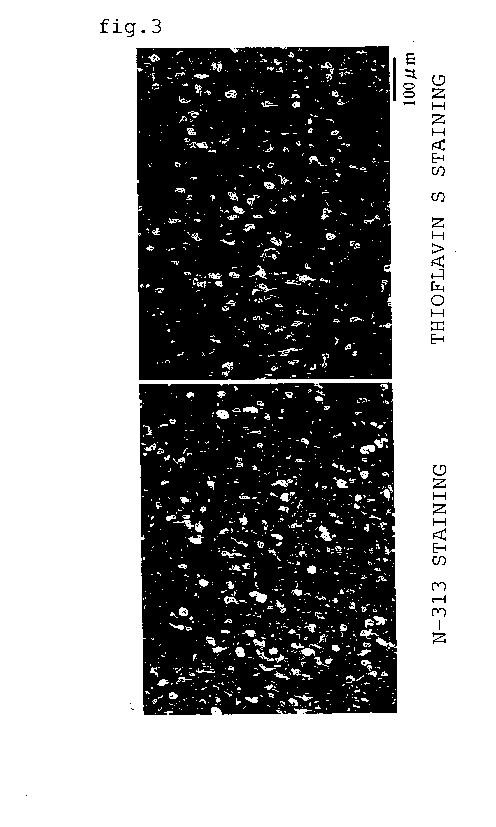 Quinoline derivative as diagnostic probe for disease with tau protein accumulation