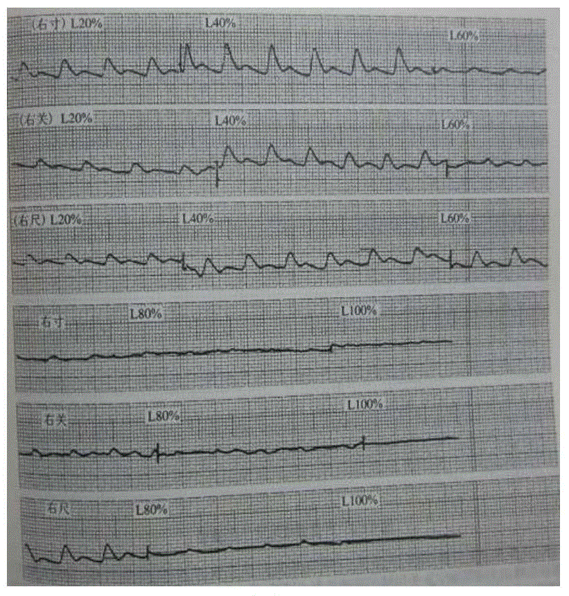 Pulse diagnosis curve grid eliminating method based on frequency domain processing