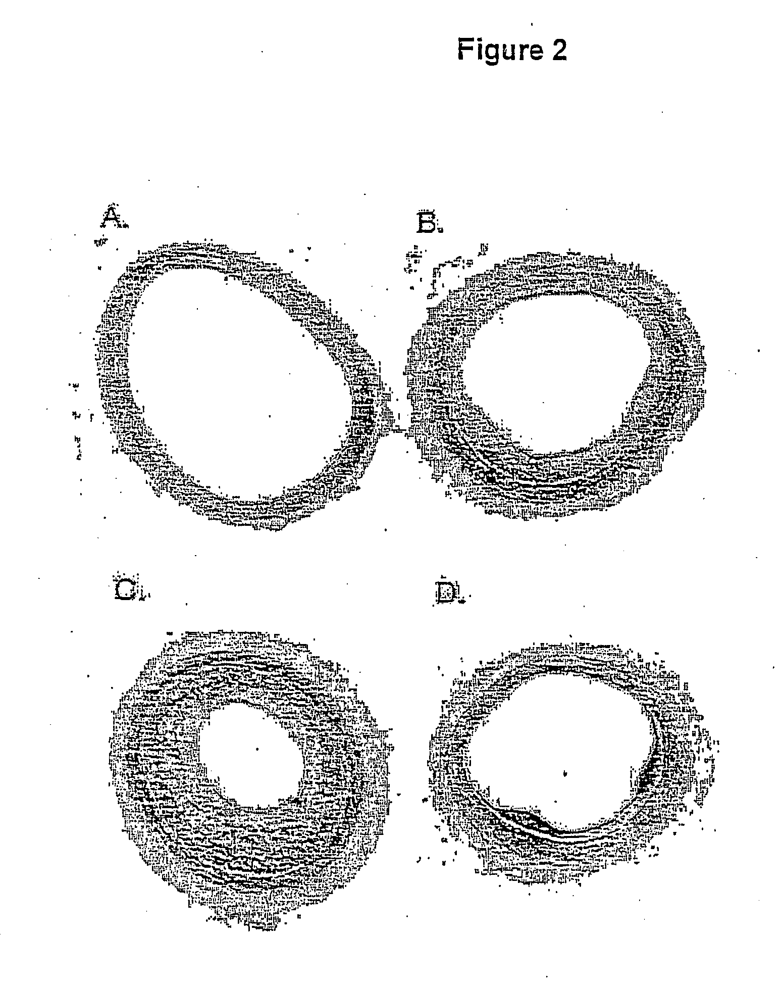 Therapeutic uses of beta-casein a2 and dietary supplement containing beta-casein a2