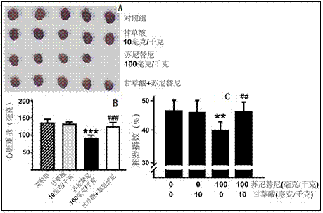 Application of glycyrrhizic acid in preparation of sunitinib malate cardiotoxicity reduction drug