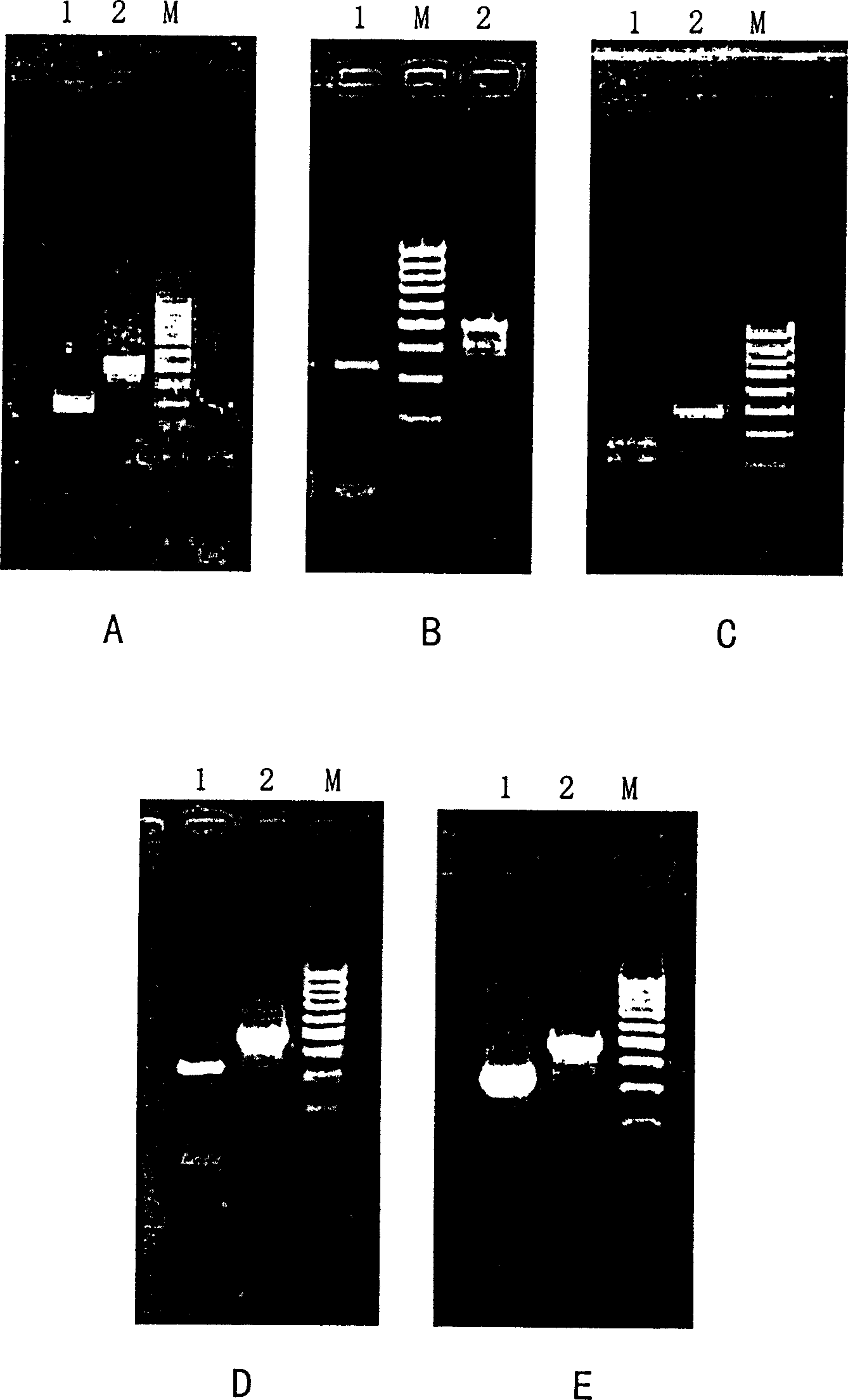 Fluorogenic quantitative PCR method for detecting interleukin 10 gene expression in peripheral-blood under physiological state