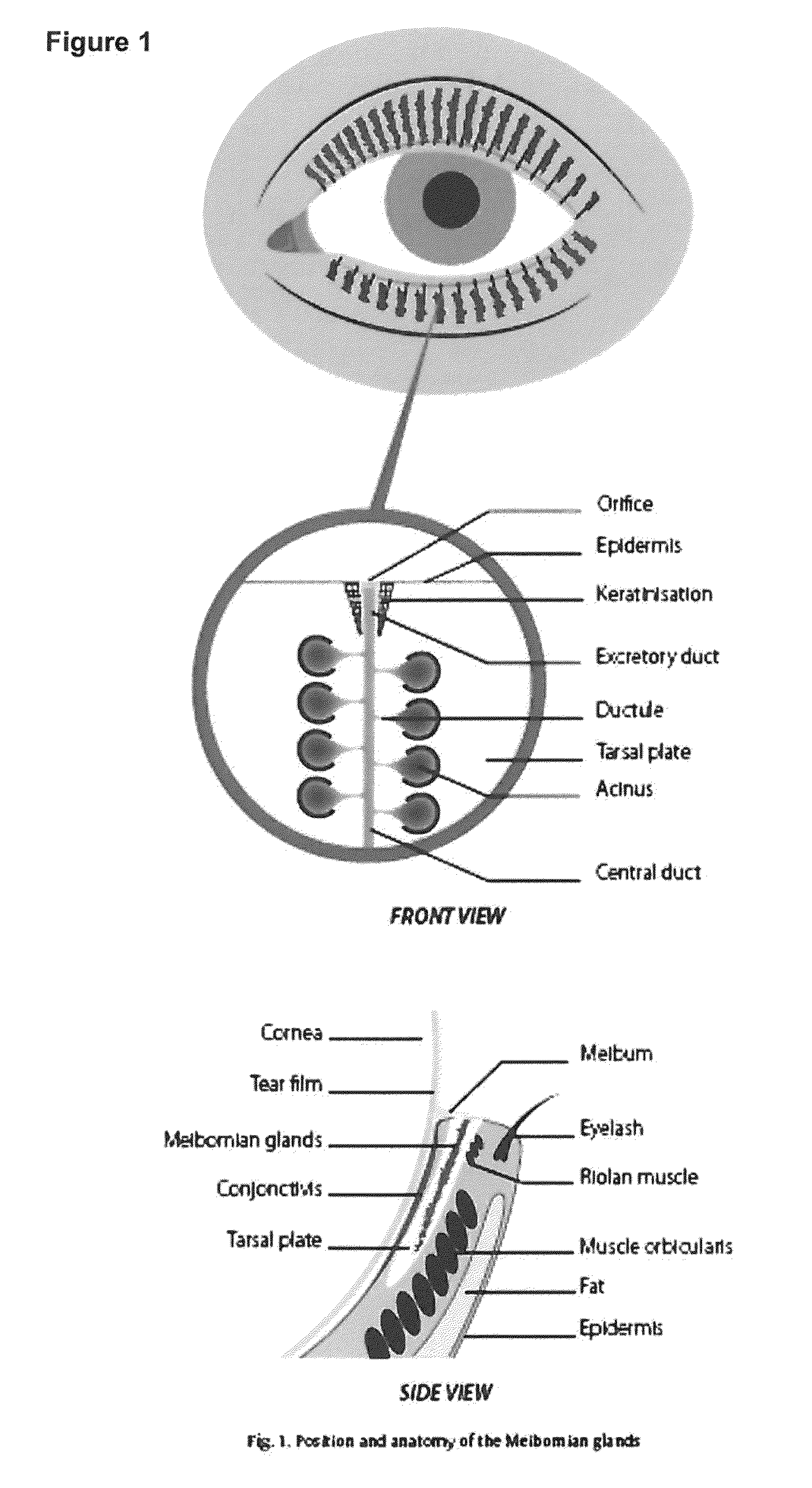 Eye massage device