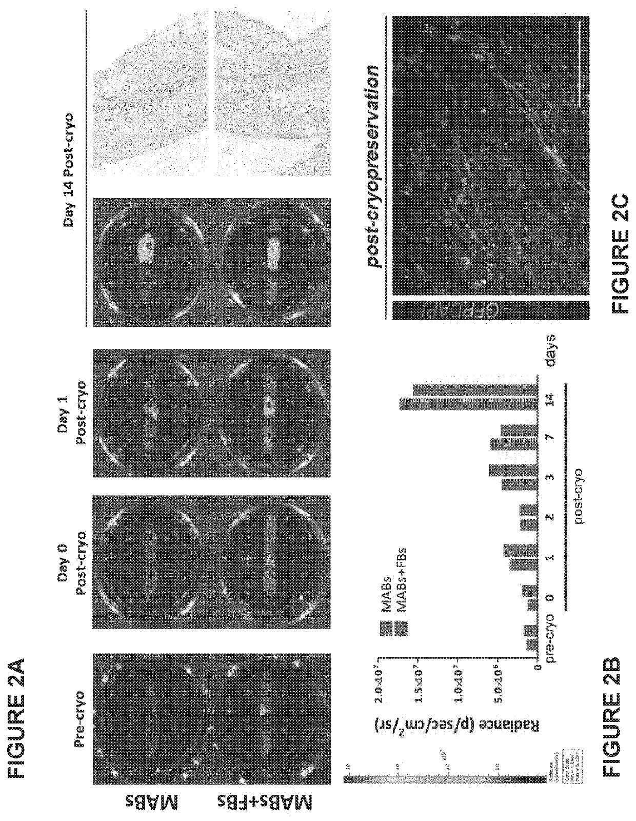 Cryopreservation