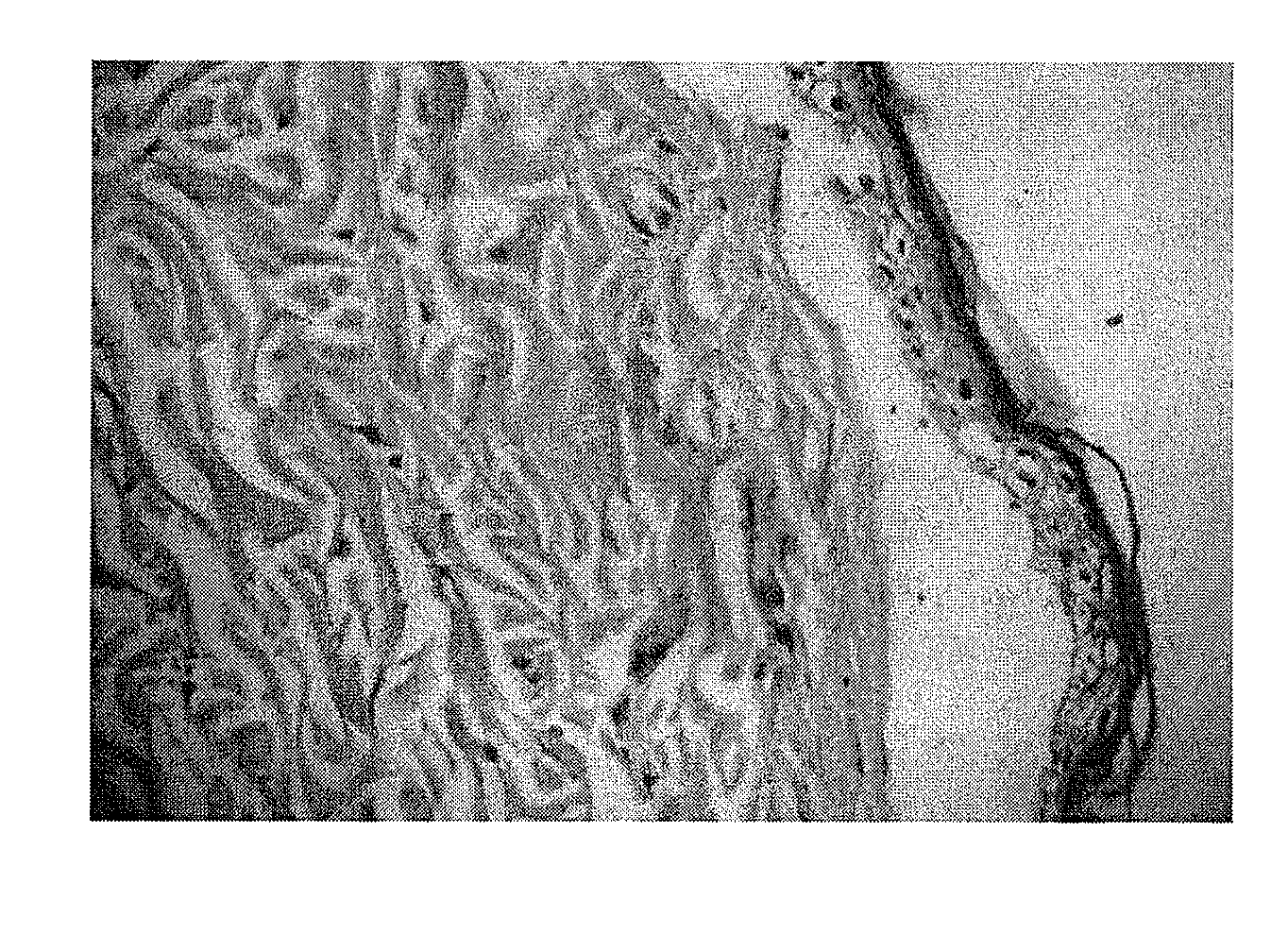 Application of puerarin in the preparation of p2x3 mediated drugs for pain/nervous system diseases