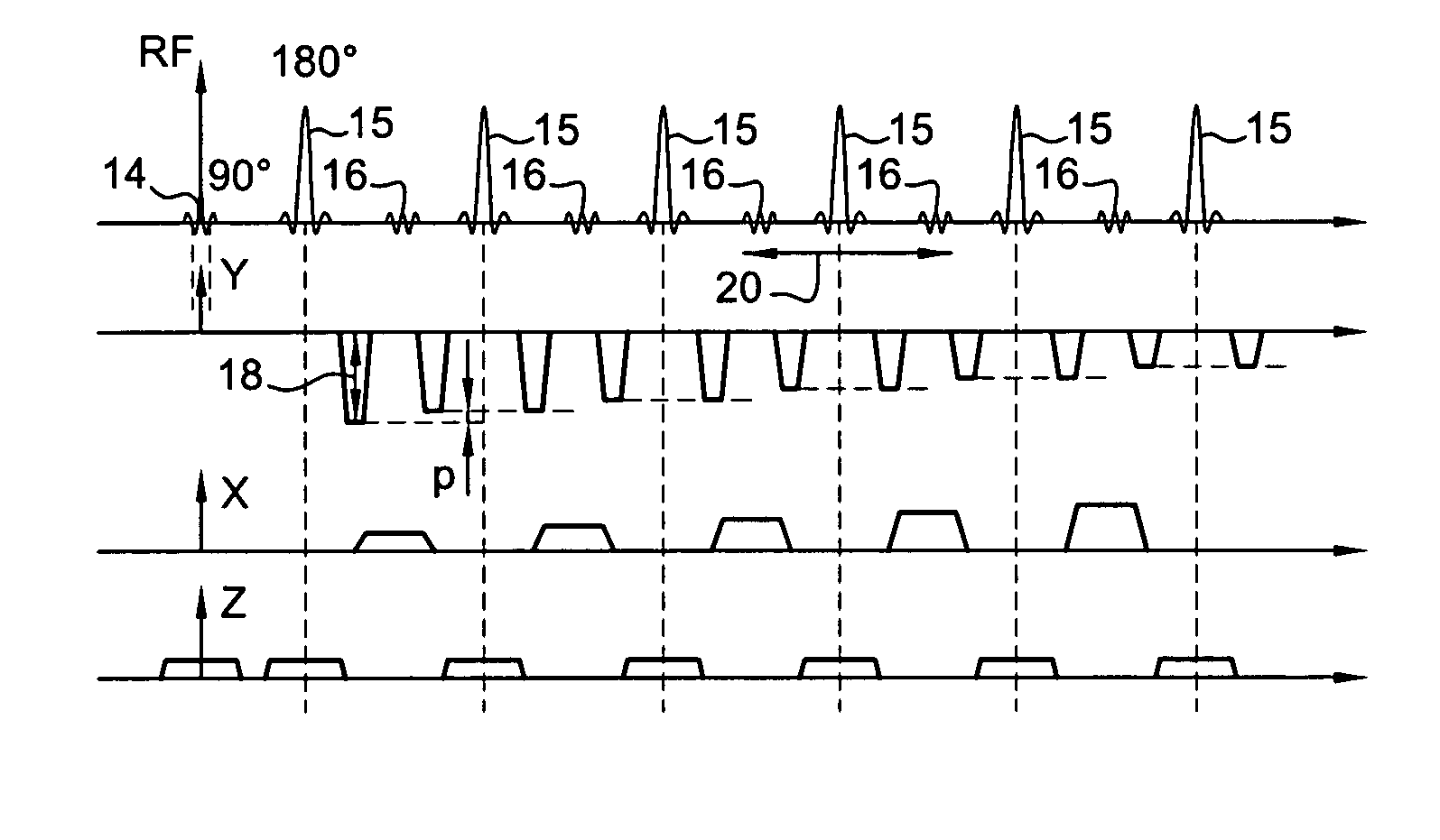 Method and apparatus for MR image acquisition