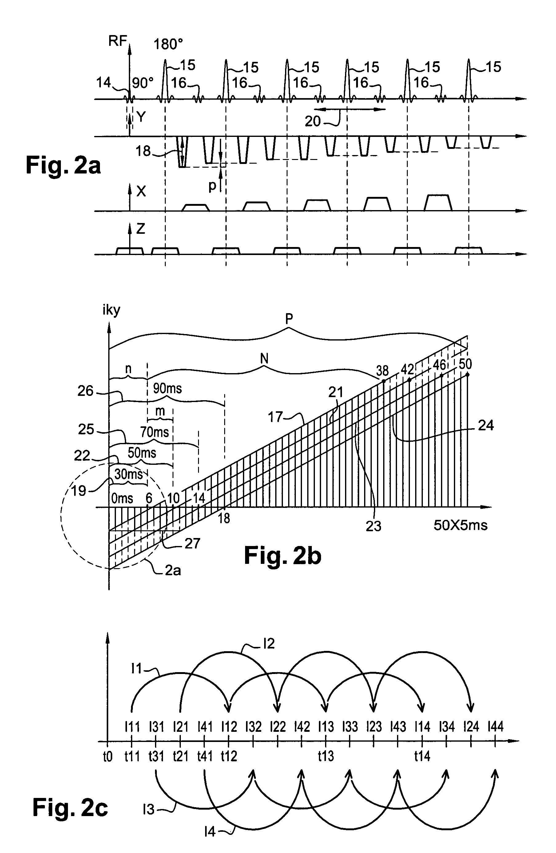 Method and apparatus for MR image acquisition