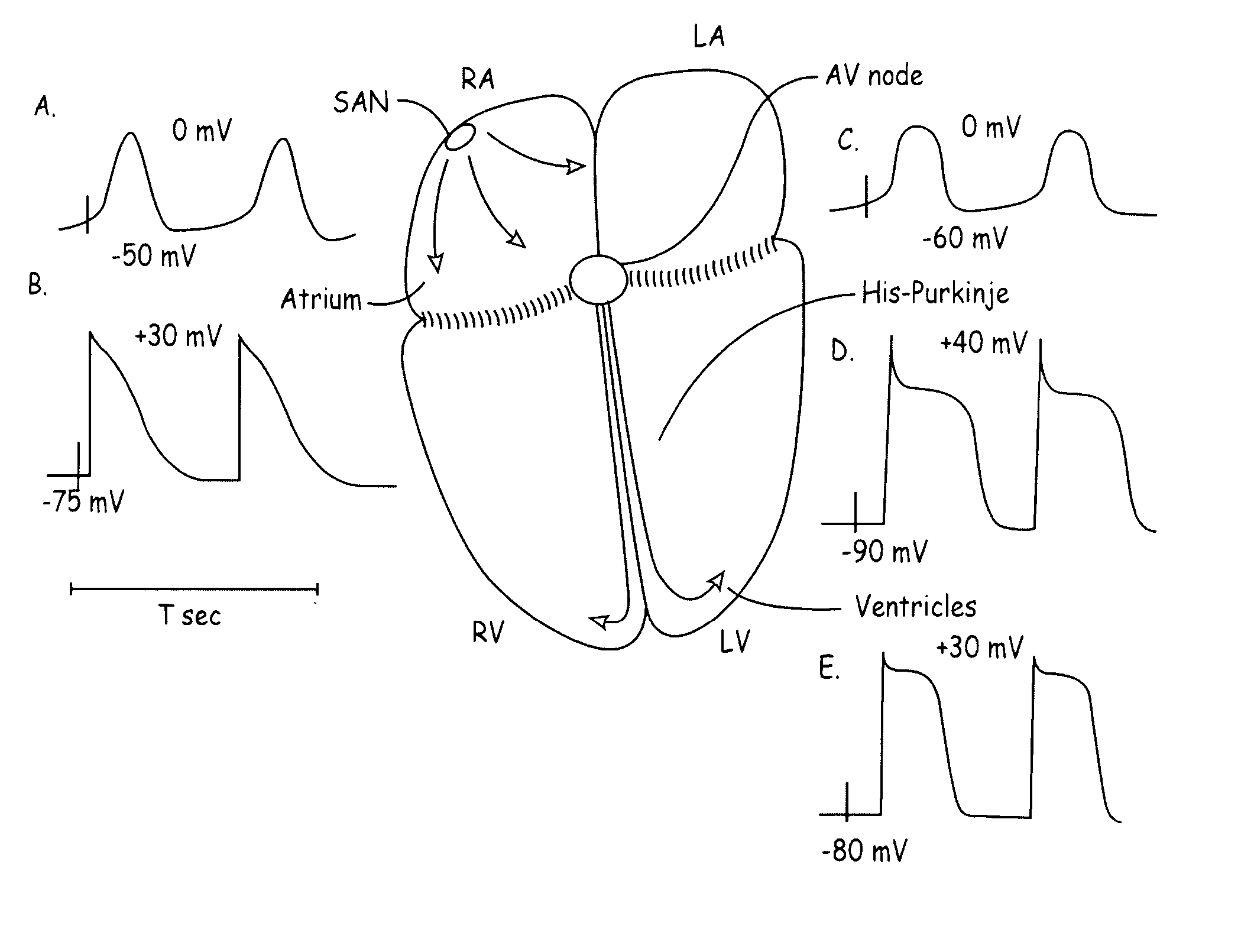 Rate control during AF using cellular intervention to modulate AV node