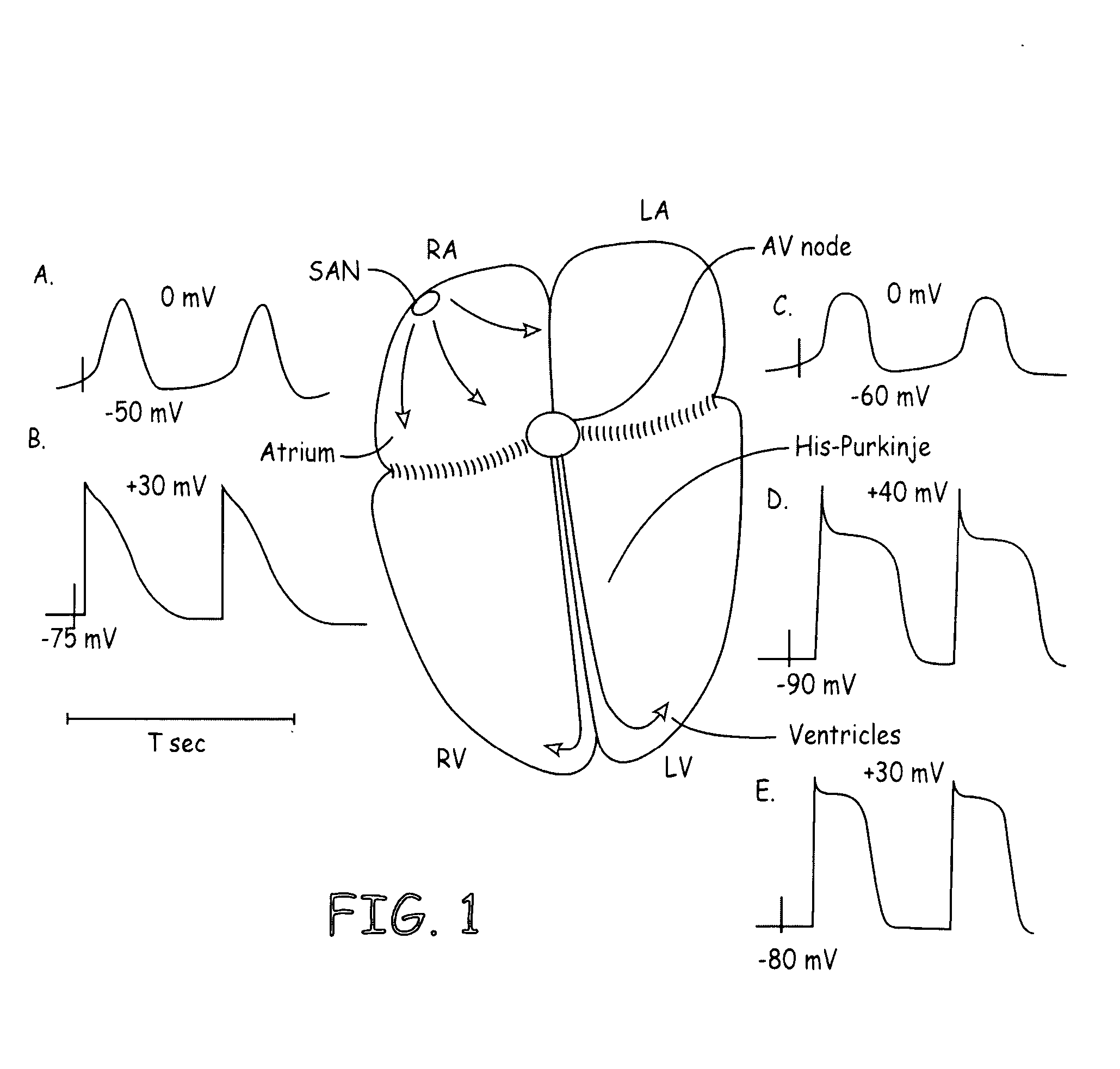 Rate control during AF using cellular intervention to modulate AV node