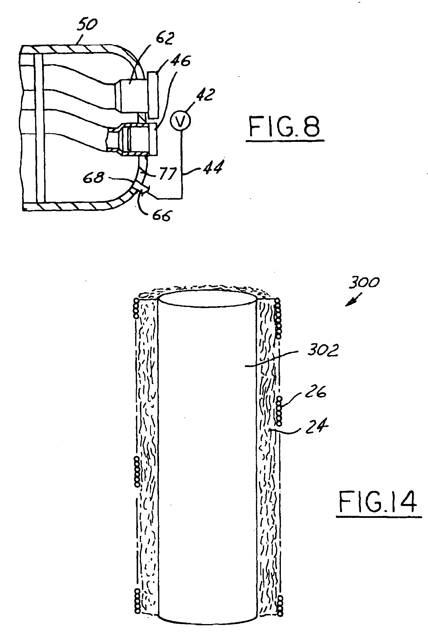 Technique to fill silencers