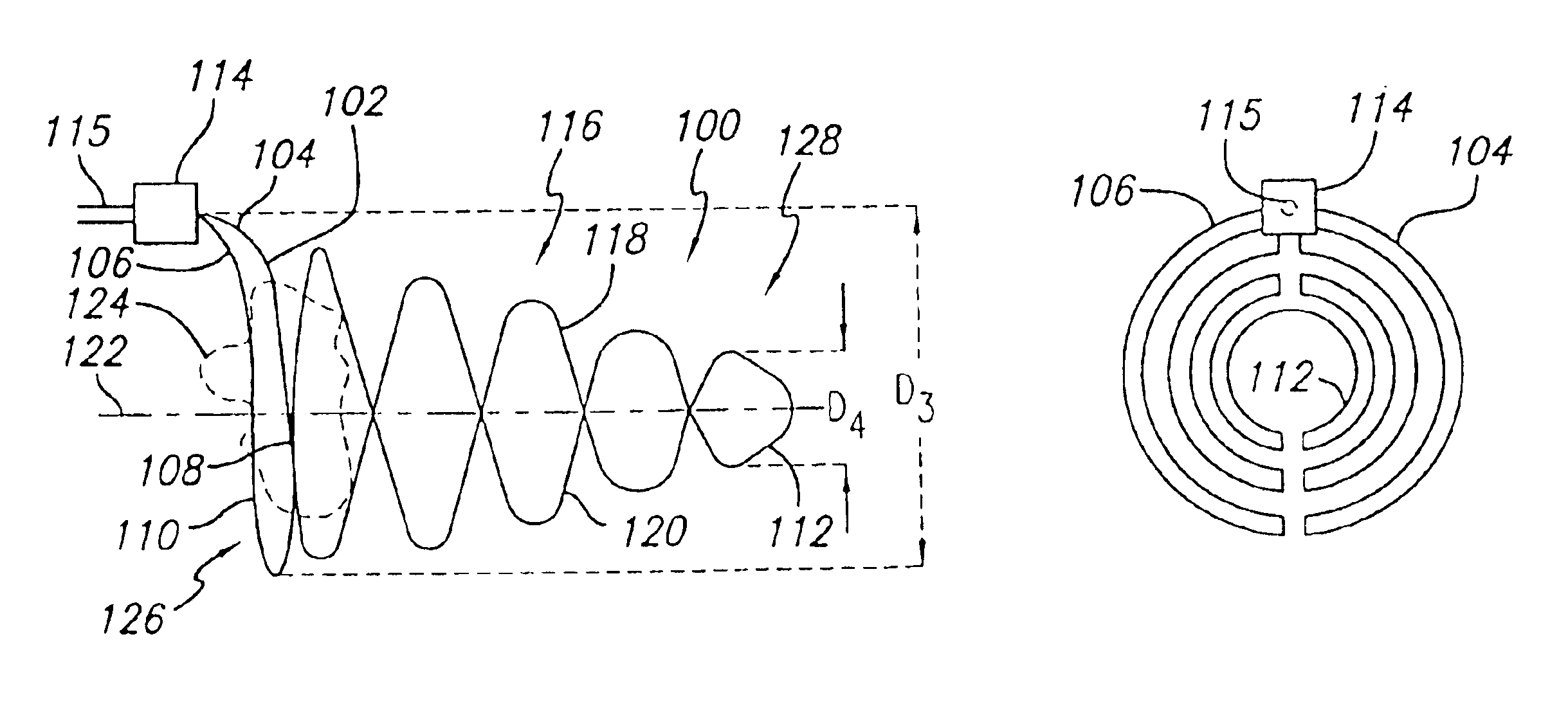 Intravascular flow modifier and reinforcement device