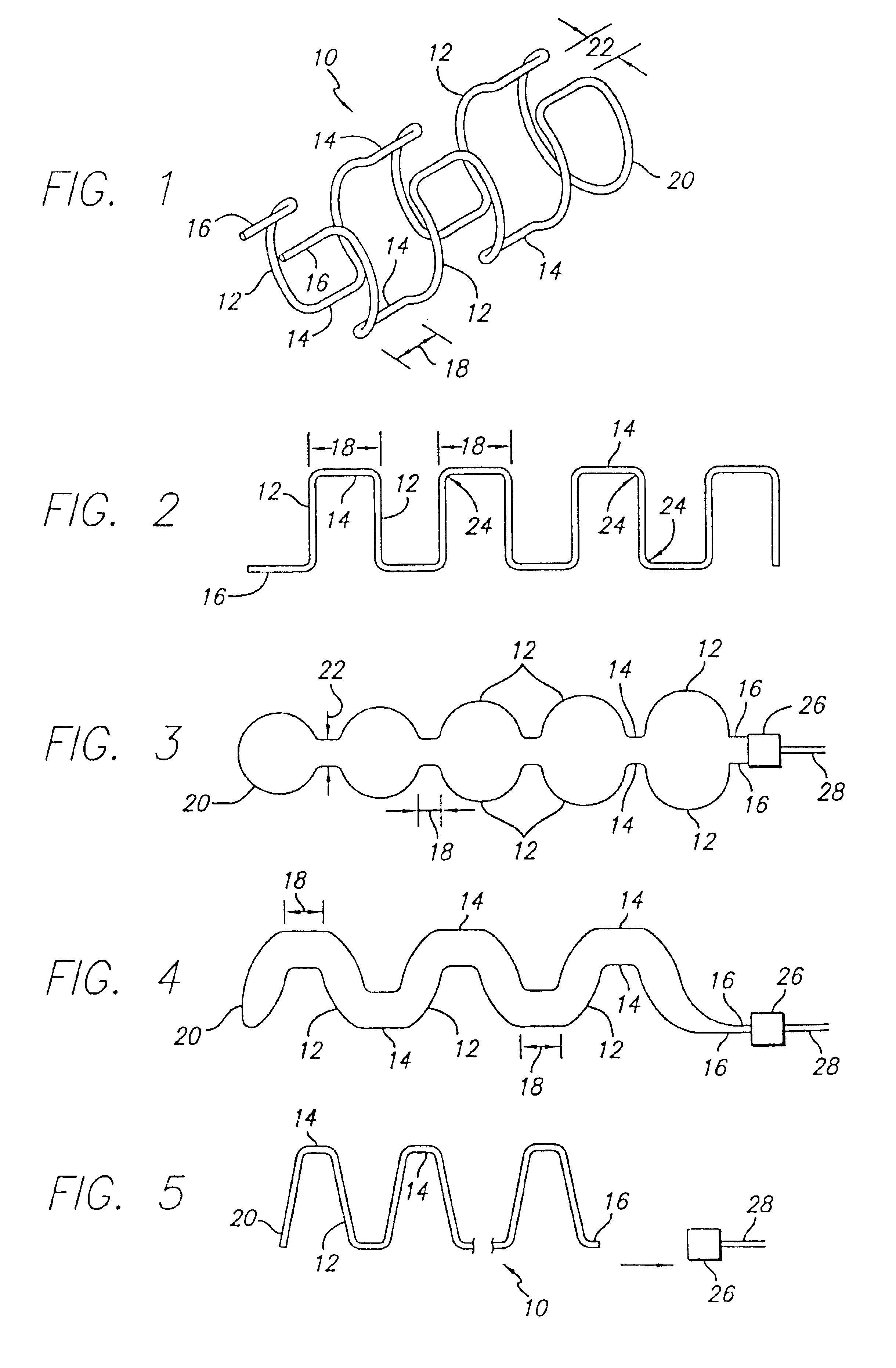 Intravascular flow modifier and reinforcement device