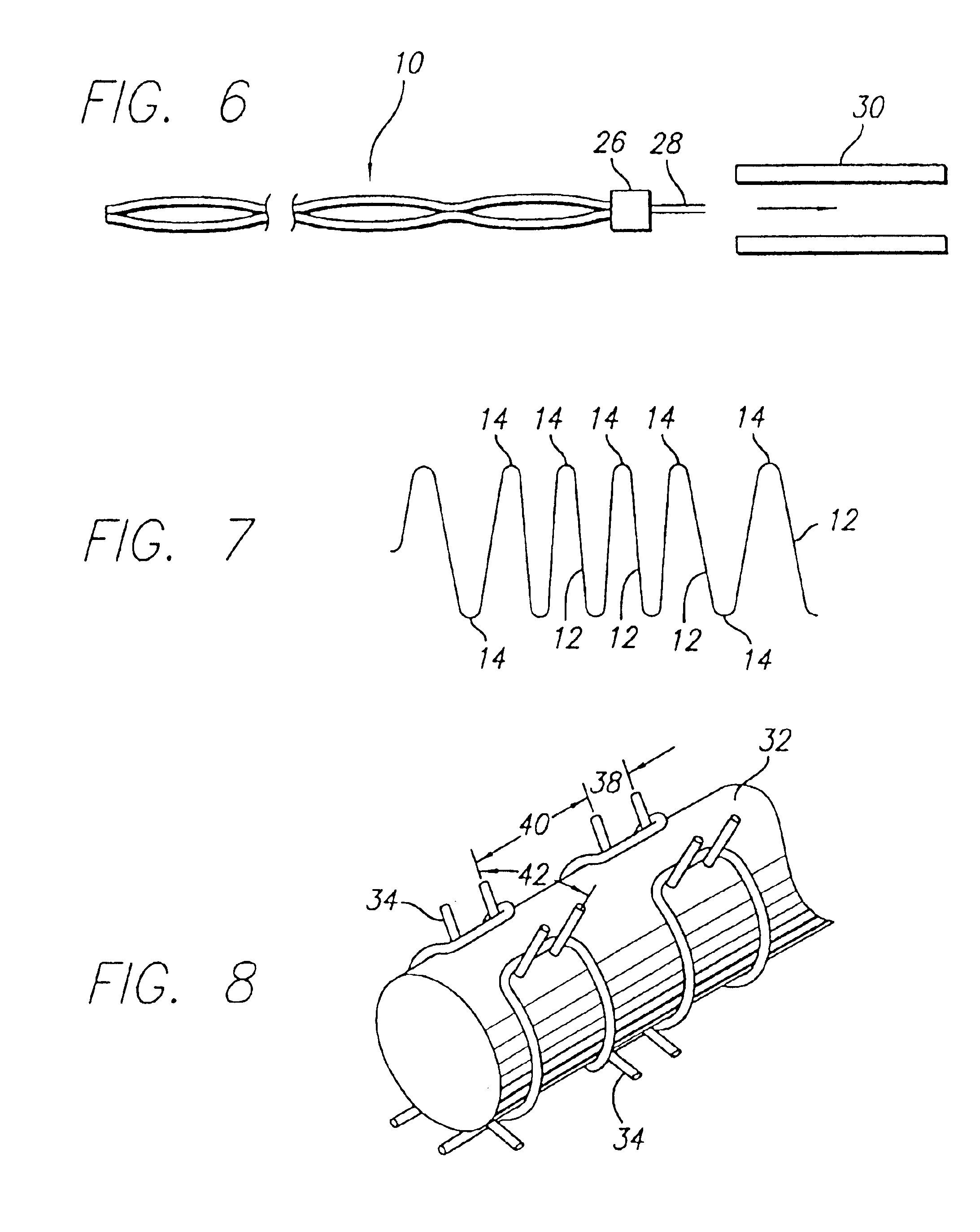 Intravascular flow modifier and reinforcement device