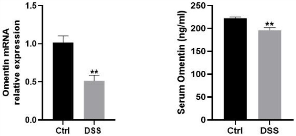 Application of retinol in preparation of medicine for treating inflammatory bowel disease