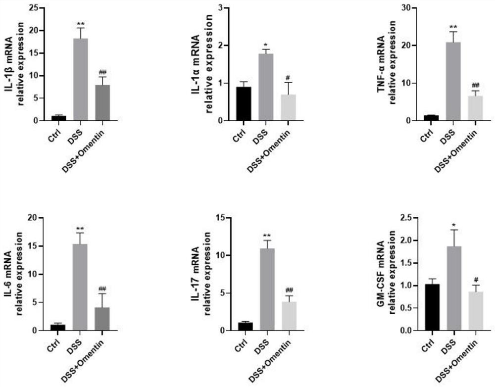 Application of retinol in preparation of medicine for treating inflammatory bowel disease